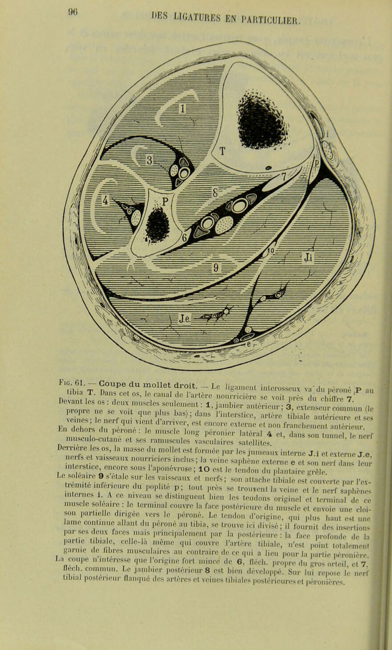 tfM 't ?» P , r°Uet^r0it- - Le ^lerosseux va'du péroné P .„ tibia T. Dans cet os, le canal derrière nourricière se voit près «In chiffre 7 Devant les os : deux muselés seulemeht : 1, jambier antérieur; 3 exté e • Inn.n (le Fn d2s I ™l 'T'0,' RSt °nC0,'° CXlenifi Ct DOn bernent antérieur. m dehors du péroné . le muscle long péronier latéral 4 et, dans son tunnel le nerf musculo-cutane et ses raniuscules vasculaires satellites Derrière les os, la masse du mollet esl formée par les jumeau* i, «e j.i externe Je nerfs et vaisseaux nourriciers inclus ; la veine saphène externe e et son nerf S tuv interstice encore sous l'aponévrose; lO est le tendon du plantaire frêle trémhé i„9rv  Y ^ 7-™* C' so atteche esSverte par IVx- tiçnnte inférieure du poplité p; tout près se trouvent la veine elle nerf saohènes internes 1 Ace niveau se distinguent bien les tendons originel et terminal de ce muscle SOléairerle terminal couvre la face postérieure du muscle et envoie une cloi- son partielle dirigée vers le péroné. Le tendon .l'origine, qui ,,,us ,,,,„ ,.<t „„, lame continue allant du péroné au tibia, se trouve ici divisé; il fournit des insertions par ses deux faces mais principalement par la postérieure : la face profonde de la partie tlbiale, celle-là même qui couvre l'artère tibiale, n'est point totalement garnie de fibres musculaires au contraire de ce qui a lieu pour la partie i.éronière La coupe ..intéresse que l'origine fort mince de 6, flêch. propre du mis orteil et 1 fléen. commun. Le jambier postérieurs est bien développé. Sur lui repose lè nerf tibial postérieur flanqué des artères et veines tibiales postérieure, et péronières