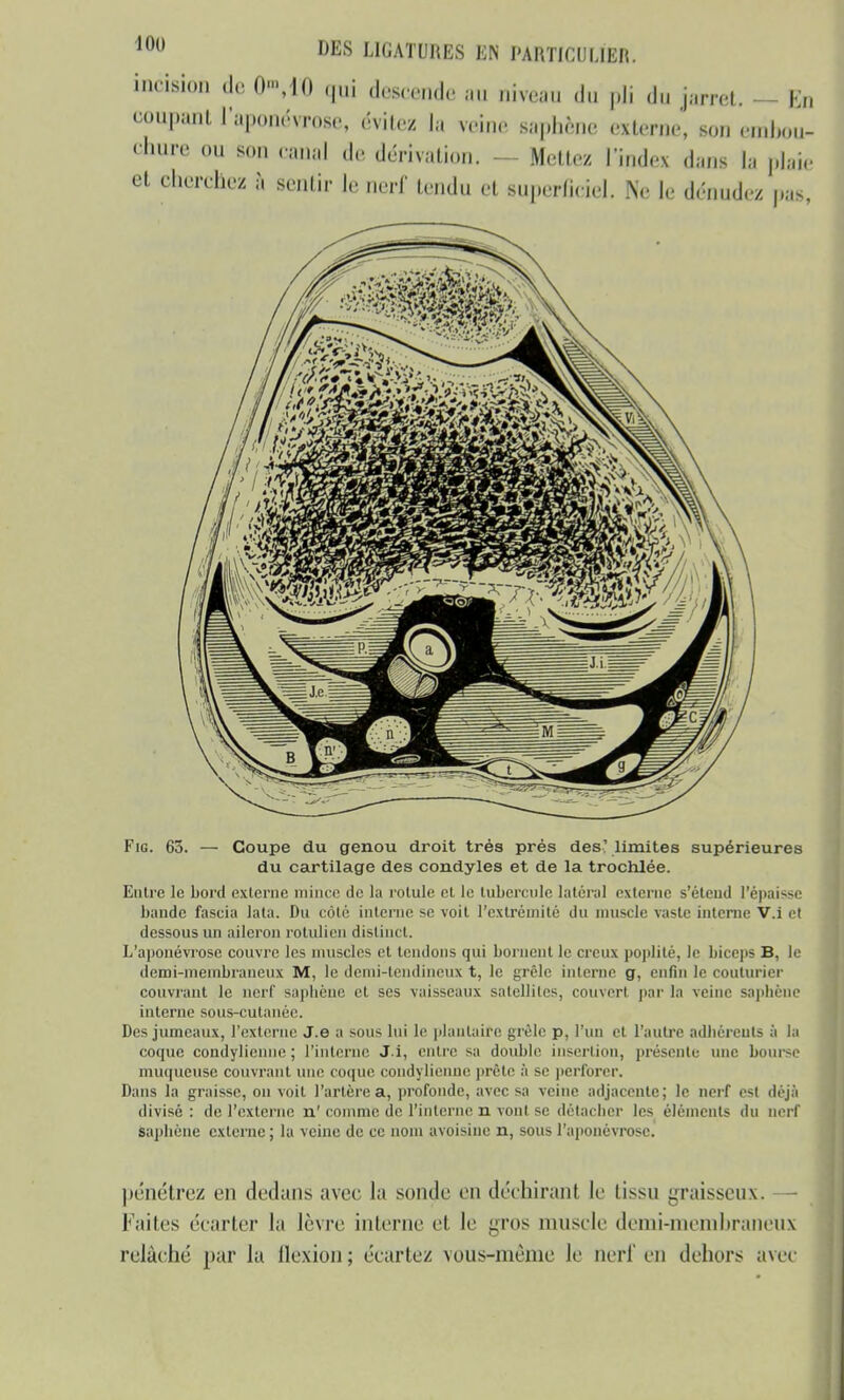 incision de 0»,i0 qui descende au niveau du pli du jarret. - - En coupant l'aponévrose, évitez la reine saphène externe, son embou- chure ou son cana] de dérivation, - - Mettez l'index dans la plaie et cherchez à sentir le nerf tendu et superficiel. Ne le dénudez pas, Fig. 65. — Coupe du genou droit très prés des' limites supérieures du cartilage des condyles et de la trochlée. Entre le bord externe mince de la rotule et le tubercule latéral externe s'éteud l'épaisse bande fascia lata. Du côté interne se voit l'extrémité du muscle vaste interne V.i cl dessous un aileron rotulien distinct. L'aponévrose couvre les muscles et tendons qui bornent le creux poplité, le biceps B, le demi-membraneux M, le demi-tendineux t, le grêle interne g, enfin le couturier couvrant le nerf sapbène et ses vaisseaux satellites, couvert par la veine sapliène interne sous-cutanée. Des jumeaux, l'externe J.e a sous lui le plantaire grêle p, l'un et l'autre adhérents à la coque condylienne ; l'interne J.i, entre sa double insertion, présente une bourse muqueuse couvrant une coque condylienne prèle ;'i se perforer. Dans la graisse, on voit l'artère a, profonde, avec sa veine adjacente; le nerf est déjà divisé: de l'externe n'comme do l'interne n vont se détacher les éléments du nerf sapbène externe; la veine de ce nom avoisine n, sous l'aponévrose. pénétrez en dedans avec la sonde en déchirant le tissu graisseux. —■ Faites écarter la lèvre interne et le gros muscle demi-membraneux relâché par la flexion ; écartez VOUS-même le nerf en dehors avec