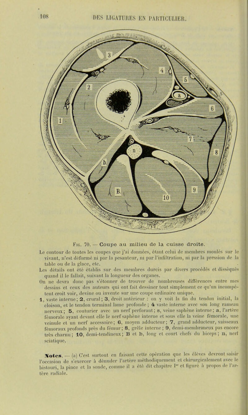 ION Fig. 70. — Coupe au milieu de la cuisse droite. Le contour de toutes les coupes que j'ai données, étant celui de membres moulés sur le vivant, n'est déformé ni par la pesanteur, ni par l'infiltration, ni par la pression de la table ou de la glace, etc. Les détails ont été établis sur des membres durcis par divers procédés et disséqués quand il le fallait, suivant la longueur des organes. On ne devra donc pas s'étonner do trouver de nombreuses différences entre mes dessins et ceux des auteurs qui ont fait dessiner tout simplement ce qu'un incompé- tent croit voir, devine ou invente sur une coupe ordinaire unique. 1, vaste interne; 2, crural ; 3, droit antérieur : on y voit la lin du tendon initial, la cloison, et le tendon terminal lame profonde ; 4 vaste interne avec son long rameau nerveux; 5, couturier avec un nerf perforant ; s. veine saphène interne; a. l'artère fémorale ayant devant elle le nerf saphène interne et sous clic la veine fémorale, une veinule et un nerf accessoire; 6, moyen adducteur; 7, grand adducteur, yaisseaus fé raux profonds près du fémur; 8, grêle interne : 9. demi-membraneui pas encore très charnu; 10, demi-tendineux; B et b, long cl court cbefs du biceps; n, nerl sciatique. Wotrs. — (a) C'est surtout en faisant cette opération que les élèves devront saisir l'occasion de s'exercer à dénuder l'artère méthodiquement et chirurgiealemeiit avec le bistouri, la pince et la sonde, comme il a été dit chapitre I et figuré à propos de l'art tère radiale.