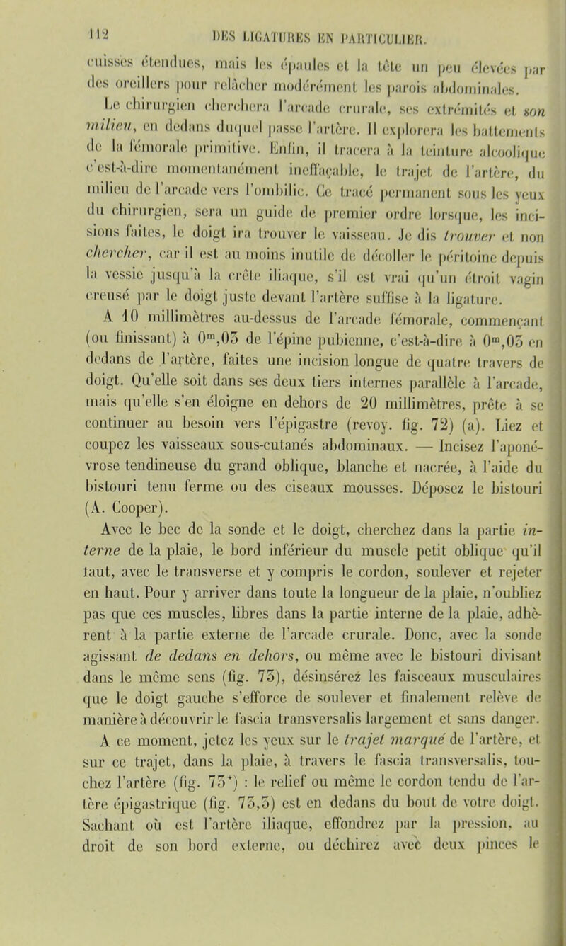 cuisses étendues, mais les épaules et la tête un peu élevée* par «les oreillers pour relâcher modérément les parois abdominale*. Le chirurgien cherchera l'arcade crurale, ses extrémités et non milieu, en dedans duquel passe l'artère. Il explorera les battements de La fémorale primitive. Enfin, il tracera à la teinture alcoolique c'est-à-dire momentanément ineffaçable, le trajet de l'artère, du milieu de l'arcade vers l'ombilic, Ce tracé permanent sous les yeux du chirurgien, sera un guide de premier ordre lorsque, les inci- sions faites, le doigt ira trouver le vaisseau. Je dis trouver et non chercher, car il est au moins inutile de décoller le péritoine depuis la vessie jusqu'à la crête iliaque, s'il est vrai qu'un étroit vagin creusé par le doigt juste devant l'artère suffise à la ligature. A 10 millimètres au-dessus de l'arcade fémorale, commençant (ou finissant) à 0m,05 de l'épine pubienne, c'est-à-dire à 0ra,05 en dedans de l'artère, faites une incision longue de quatre travers de doigt. Qu'elle soit dans ses deux tiers internes parallèle à l'arcade, mais qu'elle s'en éloigne en dehors de 20 millimètres, prête à se continuer au besoin vers l'épigastre (revoy. fig. 72) (a). Liez et coupez les vaisseaux sous-cutanés abdominaux. — Incisez l'aponé- vrose tendineuse du grand oblique, blanche et nacrée, à l'aide du bistouri tenu ferme ou des ciseaux mousses. Déposez le bistouri (À. Cooper). Avec le bec de la sonde et le doigt, cherchez dans la partie in- terne de la plaie, le bord inférieur du muscle petit oblique qu'il taut, avec le transverse et y compris le cordon, soulever et rejeter en haut. Pour y arriver dans toute la longueur de la plaie, n'oubliez pas que ces muscles, libres dans la partie interne de la plaie, adhè- rent à la partie externe de l'arcade crurale. Donc, avec la sonde agissant de dedans en dehors, ou même avec le bistouri divisant dans le même sens (fig. 75), désinscrez les faisceaux musculaires que le doigt gauche s'efforce de soulever et finalement relève de manière à découvrir le fascia transversalis largement et sans danger. A ce moment, jetez les yeux sur le trajet marqué de l'artère, cl sur ce trajet, dans la plaie, à travers le fascia transversalis, lou- chez l'artère (fig. 75*) : le relief ou même le cordon tendu de l'ar- tère épigastrique (fig. 75,5) est en dedans du bout de votre doigt. Sachant où est l'artère iliaque, effondrez par la pression, au droit de son bord externe, ou déchirez avec deux pinces le