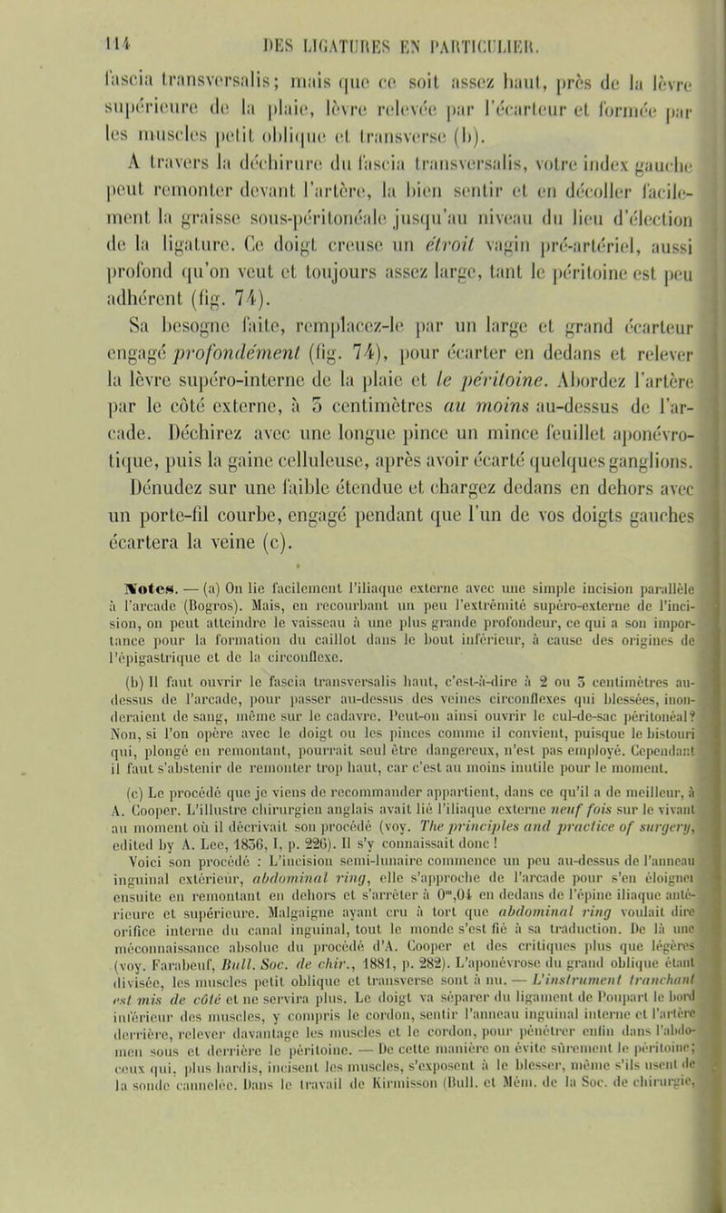 m des uc.vrniŒs en i'ahticulibr. fascia transversalîs ; mais que ce soit assez haut, près de la lèvre supérieure de la plaie, lèvre relevée par l'écarteur et formée par les muscles petit oblique et transverse (I»). À travers la déchirure du fascia transversales, voire index gauche peut remonter (levant, l'artère, la bien sentir el en décoller facile- ment la graisse sous-péritonéale jusqu'au niveau du lieu d'élection de la ligature. Ce doigt creuse un étroit vagin pré-artériel, aussi profond qu'on veut et toujours assez large, tant le péritoine est peu adhérent (fig. 74). Sa besogne faite, remplacez-le par un large et grand écarteur engagé profondément (fig. 74), pour écarter en dedans et relever la lèvre supéro-interne de la plaie et le péritoine. Abordez l'artère par le côté externe, à 3 centimètres au moins au-dessus de l'ar- cade. Déchirez avec une longue pince un mince feuillet aponévro- tique, puis la gaine celluleuse, après avoir écarté quelques ganglions* Dénudez sur une faible étendue et chargez dedans en dehors avec un porte-fil courbe, engagé pendant que l'un de vos doigts gauches écartera la veine (c). 1%'otes. — (a) On lie facilement l'iliaque externe avec une simple incision parallèle à l'arcade (Bogros). Mais, en recourbant un peu l'extrémité supéro-externe de l'inci- sion, on peut atteindre le vaisseau à une plus grande profondeur, ce qui a son impor- tance pour la formation du caillot dans le bout inférieur, à cause des origines de l'épigastrique et de la circonflexe. (b) Il faut ouvrir le fascia Iransversalis haut, c'est-à-dire à 2 ou 5 centimètres au- dessus de l'arcade, pour passer au-dessus des veines circonflexes qui blessées, inon- deraient de sang, même sur le cadavre. Peut-on :ii11si ouvrir le cul-de-sac péritonéalf Non, si l'on opère avec le doigt ou les pinces comme il convient, puisque le bistouri qui, plongé en remontant, pourrait seul être dangereux, n'est pas employé. Cependant il faut s'abstenir de remonter trop haut, car c'est au moins inutile pour le moment. (c) Le procédé que je viens de recommander appartient, dans ce qu'il a de meilleur, à A. Cooper. L'illustre chirurgien anglais avait lié l'iliaque externe neuf fuis sur le vivant au moment où il décrivait son procédé (voy. Thepl'inciples and practice of surgerm cdiled by A. Lee, 1856, I, p. 22(5). Il s'y connaissait donc ! Voici son procédé : L'incision semi-lunaire commence un peu au-dessus de l'anneau inguinal extérieur, abdominal ring, elle s'approche de l'arcade pour s'en éloigna ensuite en remontant en dehors cl s'arrêter à 0m,01 en dedans de l'épine iliaque anté- rieure et supérieure. Malgaigne ayanl cru à tort que abdominal ring voulait dira orifice interne du canal inguinal, tout le monde s'est fié à sa traduction. De là une méconnaissance absolue du procédé d'A. Cooper et des critiques plus que légères (voy. Farabeuf, Bail. Soc. de chir., 1881, p. 282). L'aponévrose du grand ohlique étant divisée, les muscles petit oblique et transverse sont à nu. — L'instrument tranchant est mis de côté et ne servira plus. Le doigt va séparer du ligament de Boupart le bord inférieur des muscles, y compris le cordon, sentir l'anneau inguinal interne et Tarière derrière, relever davantage les muscles et le cordon, pour pénétrer enfin dans l'abdo- men sous et derrière le péritoine. — De cette manière on évite sûrement le péritoine; ceux qui, plus hardis, incisent les muscles, s'exposent à le blesser, même s'ils usent de la sonde cannelée. Dans le travail de Kirmisson (Bull, et Mém. de la Soc. de chirurgie,