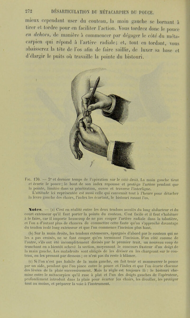 mieux cependant user du couteau, ta main gauche se bornant ;i tirer et tordre pour en faciliter l'action. Vous tordrez donc Le pouce en dehors, de manière ;i e< neucer par dégager le côté du méta- carpien qui répond à l'artère radialej et, tout en tordant, vous abaisserez la tète de l'os aliu de l'aire saillir, de luxer s;i base Cl d'élargir le puits où travaille la pointe du bistouri. Fig. 170. —3* et dernier temps de l'opération sur le côté droit. La main gauche tient et écarte le pouce; le bout do son index repousse e( protège l'artère pendant que Ja pointe, limitée dans sa pénétration, ouvre et traverse l'interligne. L'attiludp ici représentée csl aussi celle qui convenait tout à l'heure pour détacher la lèvre gauche des chairs, l'index les écartant, le bistouri rasanl l'os. H'otcs. — (a) C'est en réalité entre les deux tendons accolés du long abducteur et du court extenseur qu'il faut porter la poinle du couteau. C'est facile el il faut s'habituer à le faire, car il importe beaucoup de ne pas couper l'artère radiale dans la tabatière, et l'on a d'autant plus de chances île commettre cette faute qu'on s'approche davantage du tendon isolé long extenseur et que l'on commence l'incision plus haut. (h) Sur la main droite, les tendons extenseurs, épargnés d'abord par le couteau qui ne les a pas croisés, ne se font couper qu'en terminant l'incision. D'un côté comme «le l'autre, s'ils ont été incomplètement divisés par le premier Irait, un nouveau coup de tranchant en a bientôt achevé la section, moyennant le concours fixateur d'un doigt de la main gauche. Les maladroits sont obligés de les diviser eu les chargeant sur le cou- teau, en les prenant par dessous ; ce n'es) pas du reste à blâmer. (c) Si l'on n'est pas habile de la main gauche, on fait tenir cl manœuvrer le ponce par un aide, pendant que l'on pince entre h' pouce cl l'index el que l'on écarte chacune des lèvres île la plaie successive ni. Mais la règle est toujours là: le bistouri che- min lire h' métacarpien qu'il rase à plat et l'un des doigts gauches de l'opérateur, profondément introduit dans la plaie pour écarter les chairs, les décoller, les proléger tout au moins, el préparer la voie à l'instrument.