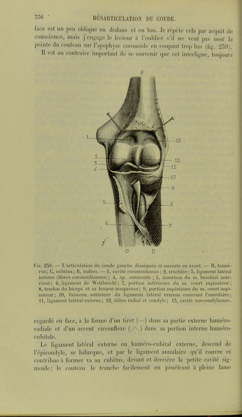 r,r,(i  DËSARTICl/LÂTIOîi DU COUDE. face est un peu oblique cm dedans et en lias. .1»! répète cela par acquit de conscience, mais j'engage le lecteur à l'oublier s'il ne veut pas user la pointe du couteau sur l'apophyse coronoïde en coupant trop lias (flg, 239). Il est au contraire important de. se souvenir (pie cet interligne, toujours FiG. 259. — L'articulation du coude gauche disséquée et ouverte en avant. — II, humé- rus; C, cubitus; R, radius. — 1, cavité coronoïdienne ; 2, trochlce; 5, ligament latéral interne, (fibres coronoïdiennes) ; 4, ap. coronoïde ; 5, insertion du m. brachial anté- rieur; 6, ligament de Weitbrècnt; 7, portion inférieure du m. court supinateur; 8, tendon du biceps el s;i bourse muqueuse; '.). portion supérieure du m. court supi- nateur; 10, faisceau antérieur du ligament latéral externe couvrant l'annulaire; 11, ligament latéral externe ; 12, sillon radial et condyle; 13, cavité sus-condylienne. regardé en face, a la forme d'un lire! (—) dans sa partie externe huméro- radialc et d'un accent circonflexe (/\) dans sa portion interne buméro- cubitale. Le ligament latéral externe ou huméro-cubital externe, descend de l'épicoridyle, se bifurque, et pâr le ligament annulaire qu'il couvre el contribue à former va au cubitus, devant et derrière la petite cavité sig- moïde; le couteau !«• tranebe facilement en pénétranl à pleine lame