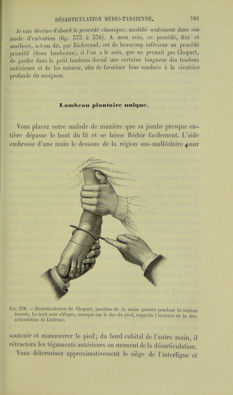 Je vais décrire d'abord [eprocédé classique, modifié seulement dans son mode d'exécution (fig; 573 à 376). A mon avis, <■<< procédé, fixé cl. amélioré, a-I-on dit, par Richerand, est de beaucoup inférieur au procédé primitif (doux lambeaux), si l'on a le soin, que ne prenait pas Chopart, de garder dans le petit lambeau dorsal une certaine longueur des tendons antérieurs et de les suturer, afin de favoriser leur soudure à la cicatrice profonde du moignon. Lambeau plantaire unique. Vous placez votre malade de manière que sa jambe presque en- tière dépasse le bout du lit et se laisse fléchir facilement; L'aide embrasse d'une main le dessous de la région sus-malle'olaire ^our Fin. 578. — Désarticulation de Cliopart, position de la main gauche pendant la section dorsale, Le trait noir oblique, marqué sur le dos du pied, rappelle l'incision de la dés- articulation de Lisfranc. soutenir et manœuvrer le pied; du bord cubital de l'autre main, il rétractera les téguments antérieurs au moment de la désarticulation. Vous déterminez approximativement le siège de l'interligne et