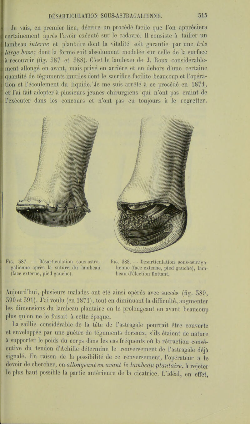 Je vais, en premier lieu, décrire un procédé' facile que l'on appréciera certainement après l'avoir exécuté sur le cadavre. 11 consiste à tailler un lambeau interne el plantaire dont la vitalité soit garantie par une. très large base; dont la forme soit absolument modelée sur celle de la surface à recouvrir (fig. 387 et 388). (Test le lambeau de J. Roux considérable- ment allongé en avant, mais privé en arrière et en dehors d'une certaine quantité de téguments inutiles dont le sacrifice facilite beaucoup et l'opéra- tion ef l'écoulement du liquide. Je me suis arrêté à ce procédé en 1871, et l'ai fait adopter à plusieurs jeunes chirurgiens qui n'ont pas craint de l'exécuter dans les concours et n'ont pas eu toujours à le regretter. galicnnc après la suture du lambeau lieuue (face externe, pied gauche), lani- (facc externe, pied gauche). beau d'élection flottant. Aujourd'hui, plusieurs malades ont été ainsi opérés avec succès (fig. 389, 590 et 591). J'ai voulu (en 1871), tout en diminuant la difficulté, augmenter les dimensions du lambeau plantaire en le prolongeant en avant beaucoup plus qu'on ne le faisait à cette époque. La saillie considérable de la tête de l'astragale pourrait être couverte et enveloppée par une guêtre de téguments dorsaux, s'ils étaient dénature à supporter le poids du corps dans les cas fréquents où la rétraction consé- cutive du tendon d'Achille détermine le renversement de l'astragale déjà signalé. En raison de la possibilité de ce renversement, l'opérateur a le devoir de chercher, en allongeant en avant le lambeau plantaire, à rejeter le plus haut possible la partie antérieure de la cicatrice. L'idéal, en effet,