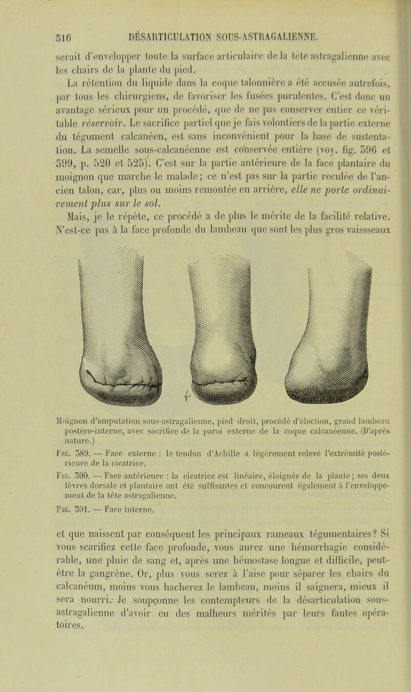 serait d'envelopper toute I;i surface articulaire de l;i téte astragaHenne avec les chairs do la plante du pied, La rétention du liquide dans la coque talonnièrea été accusée autrefois, par Ions les chirurgiens, de favoriser les l'usées purulentes. C'est donc un avantage sérieux pour un procédé, que du ne pas conserver entier ce féri- table réservoir. Le sacrifice partiel que je fais volontiers de la partie; externe du tégument calcanéen, est sans inconvénient pour la base de sustenta- tion. La semelle sous-calcanéenne est conservée entière (voy. fig. 396 et 399, p. 520 et 525). C'est sur la partie antérieure de la face plantaire du moignon que marche le malade ; ce n'est pas sur la partie reculée de l'an- cien talon, car, plus ou moins remontée en arrière, elle ne porte ordinai- rement plus sur le sol. Mais, je le répète, ce procédé a de plus le mérite de la facilité relative. N'est-ce pas à la face profonde du lambeau que sont les plus gros vaissseaux Moignon d'amputation sous-astragalienne, pied droit, procédé d'élection, grand lambeau postéro-interne, avec sacrifice de la paroi externe de la coque calcauéenno. (D'après nature.) Fjg. 589. — Face externe : le tendon d'Achille a légèrement relevé l'extrémité posté- rieure de la cicatrice. Fin. 590. — Face antérieure : la cicatrice est linéaire, éloignée de la plante; ses deux lèvres dorsale et plantaire ont été suffisantes et concourent également à l'enveloppe- ment de la tête astragalienne. Fie 591. — Face interne. et que naissent par conséquent les principaux rameaux tégumentaires? Si vous scarifiez cette face profonde, vous aurez une bémorrliagie considé- rable, une pluie de sang et, après une hémostase longue et difficile, peut- être la gangrène. Or, plus vous serez à l'aise pour séparer les chairs du calcanéum, moins vous hacherez le lambeau, moins il saignera, mieux il sera nourri. Je soupçonne les contempteurs de la désarticulation sous- astragalienne d'avoir eu des malheurs mérités par leurs fautes opéra- toires.