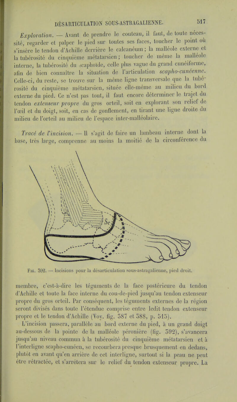 Exploration. — Avant de prendre le couteau, il faut, de toute oéces- sité, regarder et palper le pied sur toutes ses laces, toucher Le point où s'insère le tendon d'Achille derrière le calcanéuin; la malléole externe et latubérosité du cinquième méjatarsien ; toucher de même la malléole interne, la tubérosité du scaphoïde, celle plus vague du grand cunéiforme, afin de bien connaître la situation de l'articulation scapho-cunéenne. Celle-ci. du reste, se trouve sur la même ligne transversale que la tubé- rosité du cinquième métatarsien, située elle-même au milieu du bord externe du pied. Ce n'est pas tout, il faut encore déterminer le trajet du tendon extenseur propre du gros orteil, soit en explorant son relie! de l'œil et du doigt, soit, en cas de gonflement, en tirant une ligne droite du milieu de l'orteil au milieu de l'espace iiiler-malléolaire. Tracé de Vincision. —11 s'agit de l'aire un lambeau interne dont la hase, très large, comprenne au moins la moitié de la circonférence du Fie 592. — Incisions pour la désarticulation sous-astragalienne, jiictl droit. membre, c'est-à-dire les téguments de la face postérieure du tendon d'Achille et toute la lace interne du cou-de-pied jusqu'au tendon extenseur propre du gros orteil. Par conséquent, les téguments externes de la région seront divisés dans toute l'étendue comprise entre ledit tendon extenseur propre et le tendon d'Achille (Voy. fig. 587 et 588, p. 515). L'incision passera, parallèle au bord externe du pied, à un grand doigt au-dessous île la pointe de la malléole péronière (fig. 592), s'avancera jusqu'au niveau commun à la tubérosité du cinquième métatarsien et à l'interligne scapho-cunéen, se recourbera presque brusquement en dedans, plutôt en avant qu'en arrière de cet. interligne, surtout si la peau ne, peut être rétractée, et s'arrêtera sur le relief du tendon extenseur propre. La