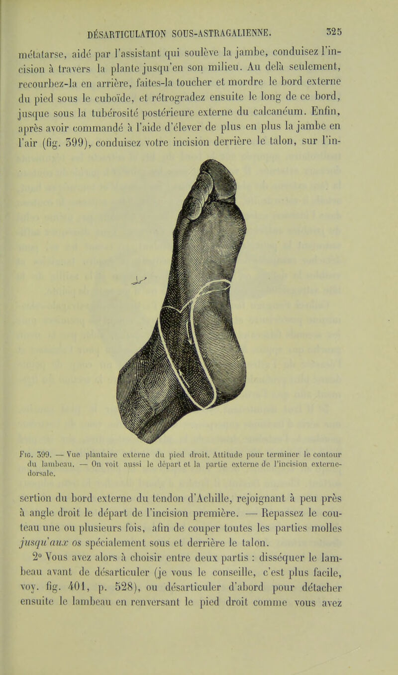 métatarse, aidé par l'assistant qui soulève la jambe, conduisez l'in- cision à travers la plante jusqu'en son milieu. Au delà seulement, recourbez-la en arrière, faites-la toucher et mordre le bord externe du pied sous le cuboïde, et rétrogradez ensuite le long de ce bord, jusque sous la tubérosité postérieure externe du calcanéum. Enfin, après avoir commandé h l'aide d'élever de plus en plus la jambe en l'air (6g. 599), conduisez votre incision derrière le talon, sur l'in- Fig. 399.—Vue plantaire externe du pied droit. Attitude pour terminer le contour du lambeau. — On voit aussi le départ et la partie externe de l'incision externe- dorsale. sertion du bord externe du tendon d'Achille, rejoignant à peu près à angle droit le départ de l'incision première. — Repassez le cou- teau une ou plusieurs fois, afin de couper toutes les parties molles jusqu'aux os spécialement sous et derrière le talon. 2° Vous avez alors â choisir entre deux partis : disséquer le lam- beau avant de désarticuler (je vous le conseille, c'est plus facile, voy. 6g. 401, p. 528), ou désarticuler d'abord pour détacher ensuite le lambeau en renversant le pied droit comme vous avez