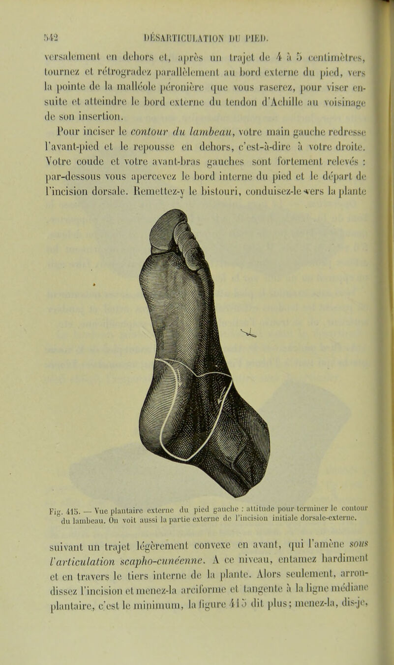 549 DKSAIiTICULA'JÏON 1)1) PIED. versaiément en dehors et, après un trajet de 4 à centimètres, tournez et rétrogradez parallèlèment au bord externe du pied, ven la pointe de la malléole péronière que vous raserez, pour viser en- suite et atteindre Le bord externe du tendon d'Achille au voisinage de son insertion. Pour inciser le contour du lambeau, votre main gauche redresse l'ayant-pied et le repousse en dehors, c'est-à-dire à votre droite. Votre coude et votre avant-bras gauches sont fortement relevés : par-dessous vous apercevez le bord interne du pied et le départ de l'incision dorsale. Remettez-y le bistouri, conduisez-levers la plante Fi. -415. — Vue plantaire externe du pied gauche : altitude pour terminer le contour du lambeau. On voit aussi la partie externe de l'incision initiale dorsale-externe. suivant un trajet légèrement convexe en avant, qui l'amène soi» l'articulation scapho-cunéenne. A ce niveau, entamez hardiment et en travers le tiers interne de la plante. Alors seulement, arron- dissez l'incision et menez-la arôiforme el tangente à la ligne médiane plantaire, c'est le minimum, la ligure iI y dit plus; menez-la, dis-je.