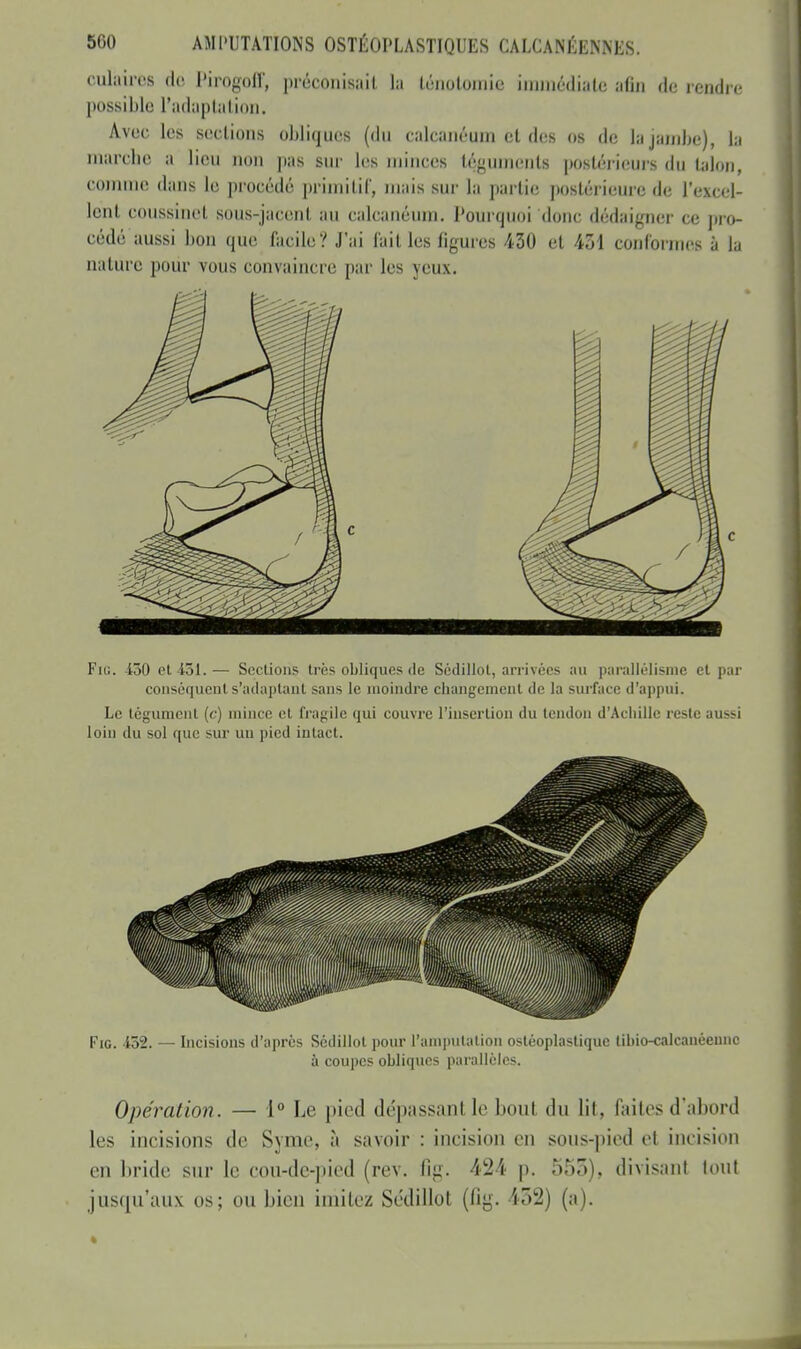 cuïàires de Pirogoff, préconisait la ténoiomic immédiate afin de rendre possible L'adaptation. Àvee les seetions obliques (du caleiinéuin et des os de la jambe), la marche a lieu non pas sur les minées téguments postérieurs du talon, comme dans le procédé primitif, niais sur la partie postérieure de L'excel- lent coussinet sous-jacent au caleanéuin. Pourquoi donc dédaigner ce pro- cédé aussi bon que facile? J'ai failles figures 430 et 451 conformes à la nature pour vous convaincre par les yeux. Fig. 430 et -451.— Sections très obliques de Sédillol, arrivées au parallélisme et par conséquent s'adaptaut sans le moindre changement de la surface d'appui. Le tégument (c) mince et fragile qui couvre l'insertion du tendon d'Achille reste aussi loin du sol que sur un pied intact. Fig. 452. — Incisions d'après Scdillot pour l'amputation ostéoplastique libio-calcanéennc à coupes obliques parallèles. Opération. — 1° Le pied dépassant le boni du lit, faites d'abord les incisions de Syme, à savoir : incision en sons-pied et incision en bride sur le coti-de-pied (rev. fig. 424 p. 555), divisant tout jusqu'aux os; on bien imitez Scdillot (fig. 452) (a).