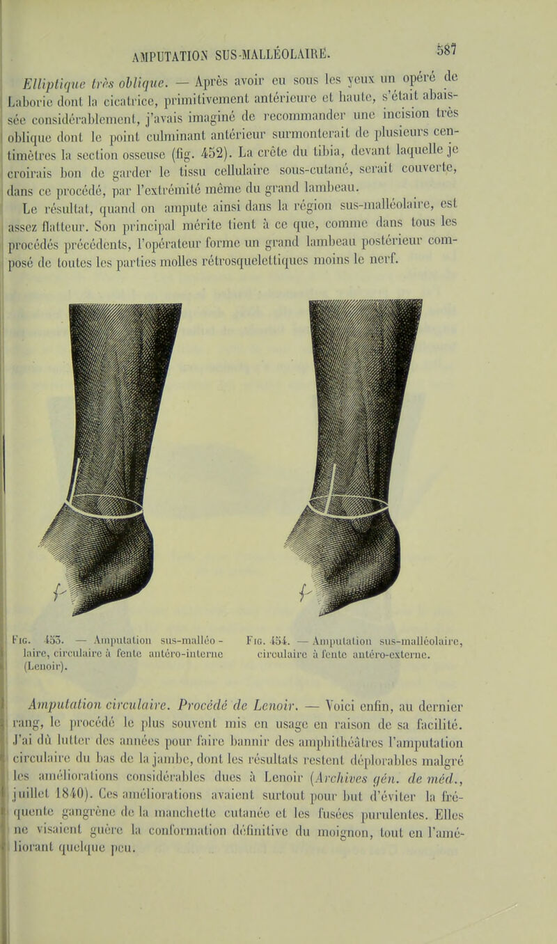 Elliptique très oblique. - Après avoir eu sous 1rs yeux un opéré de Laborie donl la cicatrice, primitivement antérieure et haute, s'était abais- sée considérablement, j'avais imaginé de recommander une incision très oblique donl le point culminanl antérieur surmonterait de plusieurs cen- timètres la section osseuse (fig. 452). La crête du tibia, devant laquelle je croirais bon de garder Le tissu cellulaire sous-cutané, serait couverte, dans ce procédé, par l'extrémité même du grand lambeau. Le résultat, quand on ampute ainsi dans La région sus-malléolaire, esl assez liai leur. Son principal mérite lient à ce que, comme dans tous les procédés précédents, L'opérateur forme un grand lambeau postérieur com- posé de toutes les parties molles rétrosqnelettiques moins le nerf. Kig. 153. — Amputation sus-malléo - taire, circulaire à feule antéro-inteme (Lcnoir). Fie. 154. — Amputation sus-malléolaire, circulaire à fente antéro-externe. Amputation circulaire. Procédé de Lcnoir. — Voici enfin, au dernier rang, le procédé le plus souvent mis en usage en raison de sa facilité. J'ai dû lutter des années pour faire bannir des amphithéâtres l'amputation > circulaire du bas de la jambe, dont les résultats restent déplorables malgré les améliorations considérables ducs à Lenoir [Archives gén. de mééL, juillet 1840). Ces améliorations avaient surtout pour but. d'éviter la fré- quente gangrène de la manchette cutanée e1 les l'usées purulentes. Elles ne visaient guère la conformation définitive du moignon, tout en l'amé- liorant quelque peu.