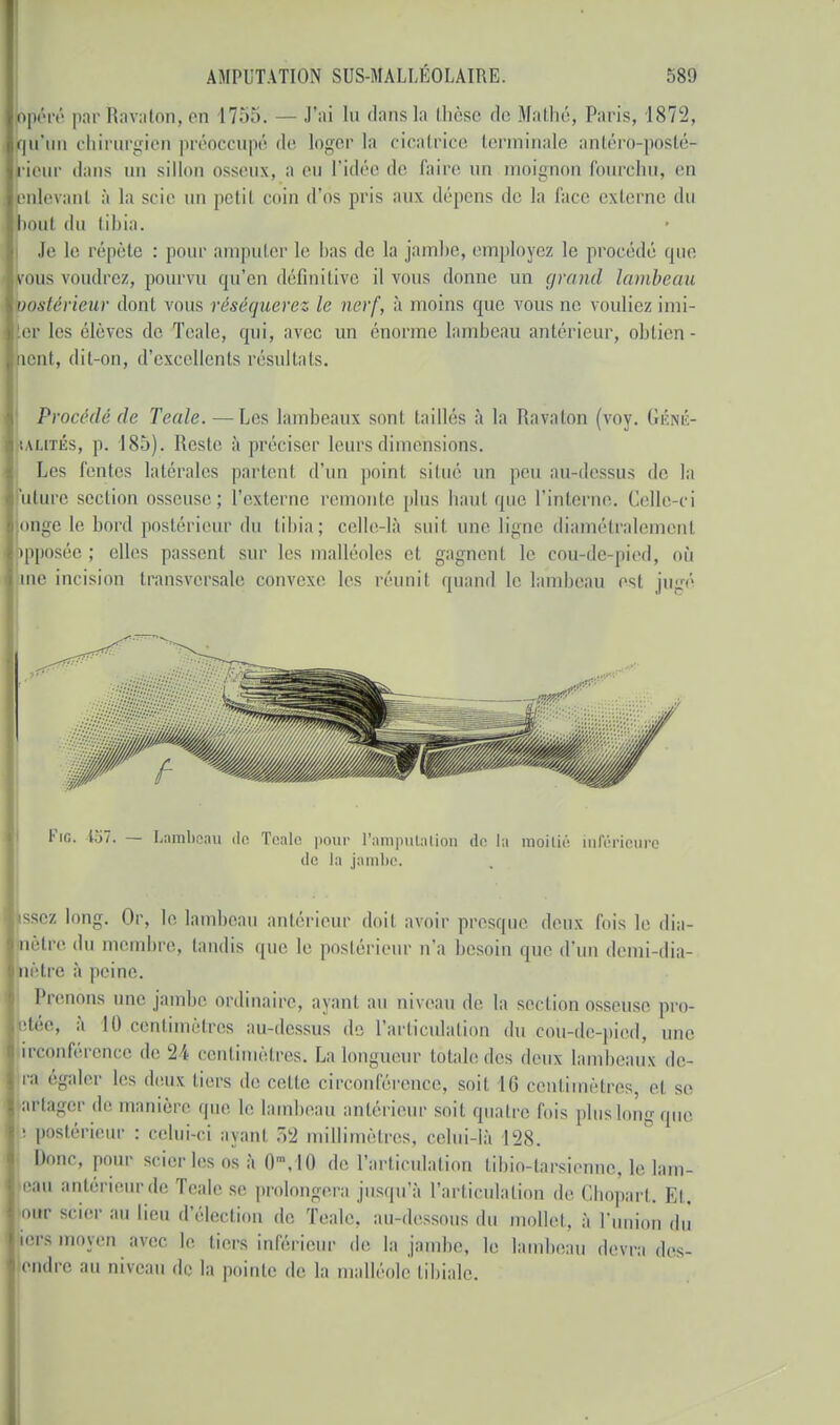 opéré par Ravaton, en 17.V>. — J'ai lu dans la thèse de Mathé, Paris, 1872, qii'un chirurgien préoccupé de loger la cicatrice terminale antérû-posté- ieur dans un sillon osseux, a eu l'idée de faire un moignon fourchu, en enlevant à la scie un petit coin d'os pris aux dépens de la face externe du oui du tibia. Je le répète : pour amputer le bas de la jambe, employez le procédé que vous voudrez, pourvu qu'en définitive il vous donne un grand lambeau postérieur dont vous réséquerez le nerf, à moins que vous ne vouliez imi- er les élèves de Teale, qui, avec un énorme lambeau antérieur, obtien- nent, dit-on, d'excellents résultats. Procédé de Teale. — Les lambeaux sont taillés à la Ravaton (voy. Géné- ialités, p. 185). Reste à préciser leurs dimensions. Les fentes latérales partenl d'un point situé un peu au-dessus de la uture section osseuse; l'externe remonte plus haut que l'interne. Celle-ci onge le boni postérieur du tibia; celle là suit une ligne diamétralement pposée ; elles passent sur les malléoles et gagnent le cou-dc-pied, où me incision transversale convexe les réunit quand le lambeau est jugé Fie. 157. Lambeau de Teale pour l'amputation de la moitié inférieure de la jambe. ssez long. Or, le lambeau antérieur doit avoir presque deux fois le dia- mètre du membre, tandis que le postérieur n'a besoin que d'un demi-dia- nètre à peine. Prenons une jambe ordinaire, ayant au niveau de la section osseuse pro- etée, à 10 centimètres au-dessus de l'articulation du coù-de-piod, une irconférence de 24 centimètres. La longueur totale des deux lambeaux di- ra égaler les deux tiers de cette circonférence, soil II! centimètres ei se artager de manière que le lambeau antérieur s,.il. quatre fois pluslongque b postérieur : celui-ci ayant 52 millimètres, celui-là 128. Donc, pour scier les os à 0M0 de l'articulation tibio-larsienne. le lam- ean antérieur de Teale se prolongera jusqu'à l'articulation de Chopart. Et. our scier au lien d'élection de Teale, au-dessous du mollet, à l'union dû iorsmoyen avec le tiers inférieur de la jambe, le lambeau devra des- cendre au niveau de la pointe de la malléole libiale.