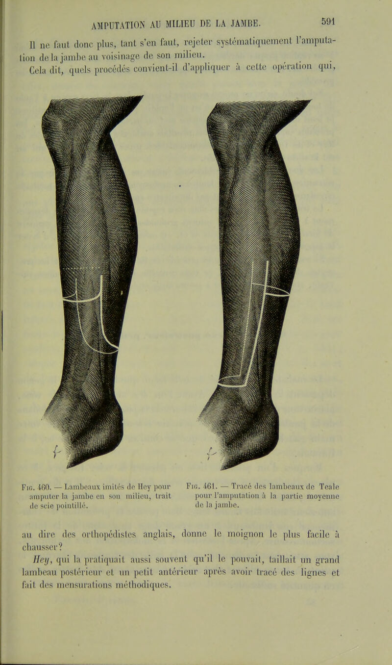 Il Qe faul donc pins. i;mt s'en faut, rejeter systématiquemenl L'amputa lion de la jambe au voisinage de son milieu. Cela dit, quels procédés convient-il d'appliquer à cette opération qui PiO. iOO. — Lambeaux imités de Hey pour Fig. 161. — Tracé dos lambeaux do Toalo amputer la jambe en sou milieu, trait pour l'amputation à la partie moyenne de scie pointillé. de la jambe. au dire des orthopédistes anglais, donne le moignon le plus facile à chausser? Hey, qui la pratiquait aussi souvenl qu'il le pouvait, taillail un grand lambeau postérieur el un petit antérieur après avoir tracé des ligues el fait des mensurations méthodiques,