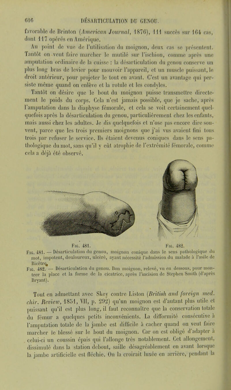 favorable de Brinton (American Journal, 1870), 111 succès sur 104 cas, donl 117 opérés en Amérique. Au point de Vue de l'utilisation du inoignon, doux cas se. présentent. Tantôt on veut l'aire marcher le mutilé sur l'ischion, comme après une amputation ordinaire de la cuisse, : la désarticulation du genou conserve un plus long bras de levier pour mouvoir l'appareil, et un muscle puissant, le droit antérieur, pour projeter le tout en avant. C'est un avantage; qui per- siste même quand on enlève el la rotule et les condyles. Tantôt on désire que le bout du moignon puisse transmettre directe- ment le poids du corps. Cela n'est jamais possible, que je sacbe, après l'amputation dans la diapbyse fémorale, et cela se voit certainement quel- quefois après la désarticulation du genou, particulièrement chez les enfants, mais aussi chez les adultes. Je dis quelquefois cl n'ose pas encore dire sou- vent, parce que les trois premiers moignons que j'ai vus avaient fini tous trois par refuser le service. Ils étaient devenus coniques dans le sens pa- thologique du mot, sans qu'il y eût atrophie de l'extrémité fémorale, comme cela a déjà été observé. Fig. 481. Fig. 482. Fig. 481. — Désarticulation du genou, moignon conique dans le sens pathologique du mot, impotent, douloureux, ulcéré, ayant nécessité l'admission du malade à l'asile de Bicélre^ Fig. 482. — Désarticulation du genou. Bon moignon, relevé, vu en dessous, pour mon- trer la place et la forme de la cicatrice, après l'incision de Stephcn Smith (d'après Bryant). Tout en admettant avec Skcy contre Liston (British and foreujn med. chir. Revieiv, 1851, Yll, p. 292) qu'un moignon est d'autant plus utile el puissant qu'il est plus long, il faut reconnaître que la conservation totale du fémur a quelques pet ils inconvénients. La difformité consécutive à l'amputation totale de la jambe est difficile à cacher quand on veut faire marcher Je blessé sur le bout du moignon. Car on est obligé d'adapter à celui-ci un coussin épais qui l'allonge très notablement. Cet allongement, dissimulé dans la station debout, saille désagréablement en avant lorsque la jambe artificielle est fléchie. On la croirait luxée en arrière, pendant la