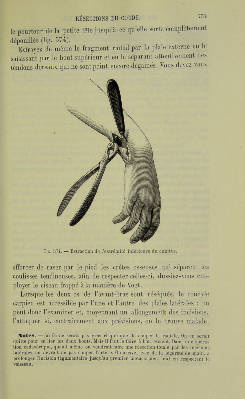 le pourtour de la petite tète jusqu'à ce qu'elle sorte complètemen dépouillée (fig. 574). Extrayez de même le fragment radial par la plaie externe en l( saisissant par le bout supérieur et en le séparant attentivement dei tendons dorsaux qui ne sont point encore dégainés. Vous devez voin Fig. 374. — Exlracliou de l'extrémilii inférieure du cubitus. efforcer de raser par le pied les crêtes osseuses qui séparent les coulisses tendineuses, afin de respecter celles-ci, dussiez-vous em- ployer le ciseau frappé à la manière de Vogt. Lorsque les deux os de l'avant-bras sont réséqués, le condyle carpien est accessible par l'une et l'autre des plaies latérales : on peut donc l'examiner et, moyennant un allongemeiît des incisions, l'attaquer si, contrairement aux prévisions, on le trouve malade. IVotcs. — (a) Ce ne serait pas gros risque que de couper la radiale. On en scrail quille pour en lier les deux bouts. Mais il faut le faire à bon escient. Dans une opéra- tion cadavérique, quand même on voudrait faire une résection totale par les incisions latérales, on devrait ne pas couper l'artère. On arrive, avec de la légèreté de main, à prolonger l'iucisiou téguuieulaire jusqu'au premier métacarpien, tout en respectani le vaisseau.