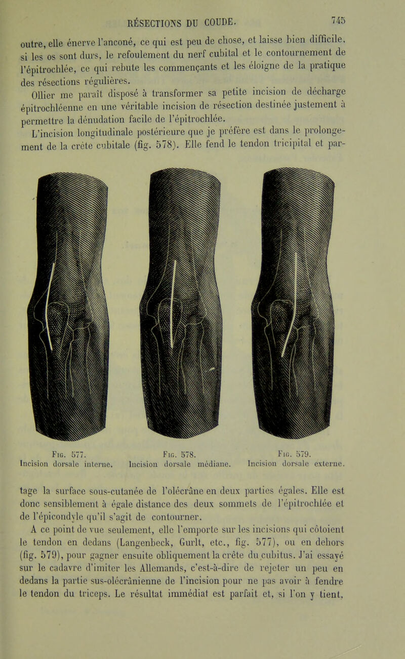 outre, elle énerve l'anconé, ce qui est peu de chose, et laisse bien difficile, si les os sont durs, le refoulement du nerf cubital et le contournement de l'épitrochlée, ce qui rebute les commençants et les éloigne de la pratique des résections régulières, Ollier me paraît disposé à transformer sa petite incision de décharge épitrochléenne en une véritable incision de résection destinée justement à permettre la dénudation facile de l'épitrochlée. L'incision longitudinale postérieure que je préfère est dans le prolonge- ment de la crête cubitale (fig. 578). Elle fend le tendon tricipilal et par- FiG. '611. Fifi. 578. Fiii. 579. Incision dorsale inlcrne. Incision dorsale médiane. Incision dorsale externe. tage la surface sous-cutanée de l'olécrâne en deux parties égales. Elle est donc sensiblement à égale dislance des deux sommets de l'épitrochlée et de l'épicondylc qu'il s'agit de contoiu-ner. A ce point de vue seulement, elle remporte sur les incisions qui côtoient le tendon en dedans (Langenbeck, Gurlt, etc., fig. 577), ou en dehors (fig. 579), pour gagner ensuite obliquement la crête du cubitus. J'ai essayé sur le cadavre d'imiter les Allemands, c'est-à-dire de rejeter un peu en dedans la partie sus-olécrànienne de l'incision pour ne pas avoir à fendre le tendon du triceps. Le résultat immédiat est parfait et, si l'on y tient.