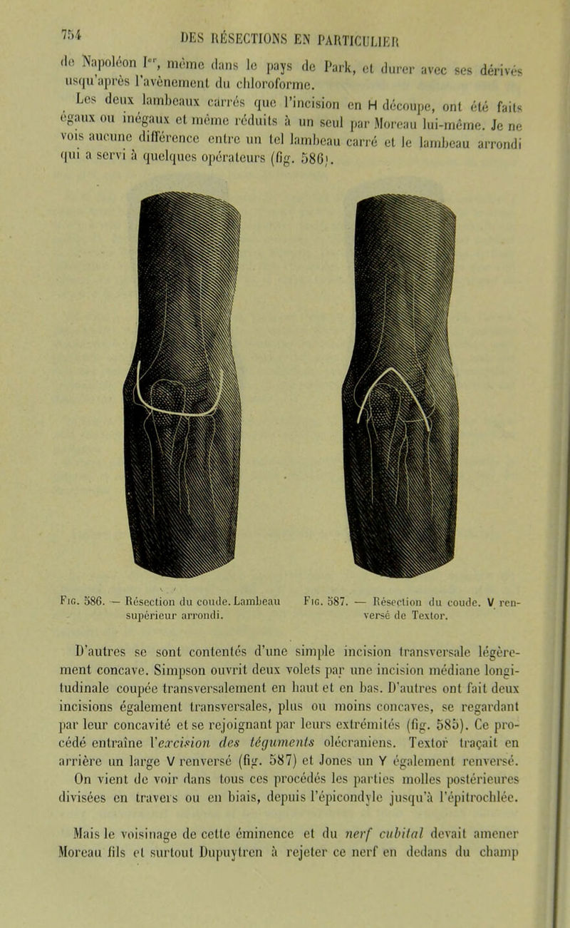 (lo Napoléon I-, môme dans le pays de Park, ot ,l,„cr avec ses dérivé, usqu après l'avènemenl du chloroforme. Les deux lambeaux carrés que l'incision en H découpe, ont été faits égaux ou inégaux et mémo réduits à un seul par .Moi-eau lui-même. Je ne vois aucune différence entre un tel lambeau carré et le lambeau arrondi qui a servi à quelques opérateurs (fig. 586). FiG. 586. — Résection du coude. Lambeau Fie. o87. — Résection du coude. V rcn- supérieur arrondi. versé de Textor. D'autres se sont contentés d'une simple incision transversale légère- ment concave. Simpson ouvrit deux volets par une incision médiane longi- tudinale coupée transversalement en haut et en bas. D'autres ont fait deux incisions également transversales, plus ou moins concaves, se regardant parleur concavité et se rejoignant par leurs extrémilés (fig. 585). Ce pro- cédé entraîne Vexcmo7i des téguments olécraniens. Textor traçait en arrière un large V renversé (fig. 587) et Jones un Y également renversé. On vient de voir dans tous ces procédés les parties molles postérieures divisées en travers ou en biais, depuis l'épicondyle jusqu'à l'épitrochléc. Mais le voisinage de cette cminence et du nerf cubital devait amener Moreau fils et surtout Dupuytren à rejeter ce nerf en dedans du champ
