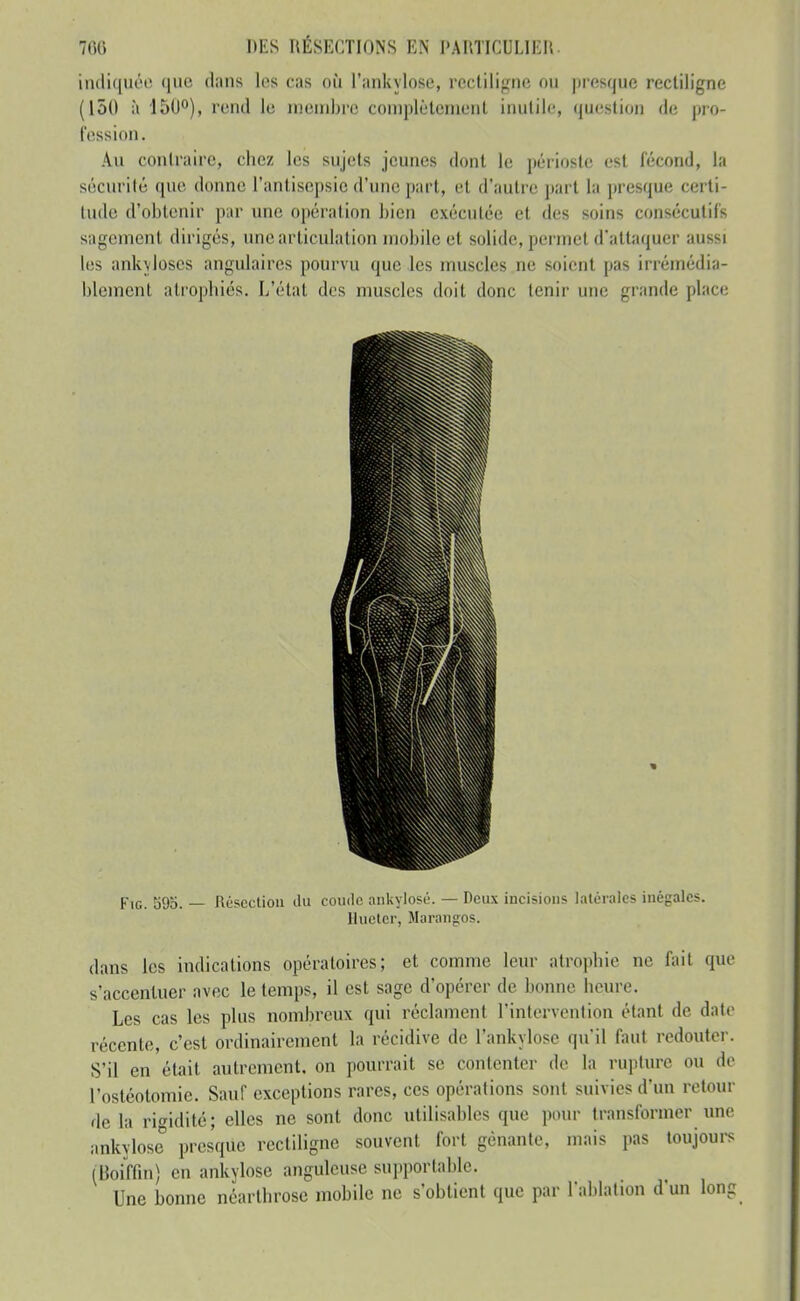 indiquée que dans les cas où l'ankylose, rectiligne ou presque rectiligne (150 à 150), rend le membre complètement inutile, (|U('stion de pro- fession. An conlraire, chez les sujets jeunes dont le périoste est fécond, la sécurité que donne l'antisepsie d'une part, et d'autre ])art la presque certi- tude d'obtenir par une opération bien exécutée et des soins consécutifs sagement dirigés, une articulation mobile et solide, permet d'attaquer aussi l(js ank^loscs angulaires pourvu que les muscles ne soient pas irrémédia- blement alropliiés. L'état dos muscles doit donc tenir une grande place FiG. S95. Résection du coude aiikylosé. — Deux incisions latérales inégales. Huctcr, Marangos. dans les indications opératoires; et comme leur atrophie ne fait que s'accentuer avec le temps, il est sage d'opérer de bonne heure. Les cas les plus nombreux qui réclament l'intervention étant de date récente, c'est ordinairement la récidive de l'ankylose qu'il faut redouter. S'il en était autrement, on pourrait se contenter de la rupture ou de l'ostéotomie. Sauf exceptions rares, ces opérations sont suivies d'un retour fie la rigidité; elles ne sont donc utilisables que pour transformer une ankylose presque rectiligne souvent fort gênante, mais pas toujours (Boiffm) en ankylose anguleuse supportable. Une bonne néarthrosc mobile ne s'obtient que par l'ablation d'un long