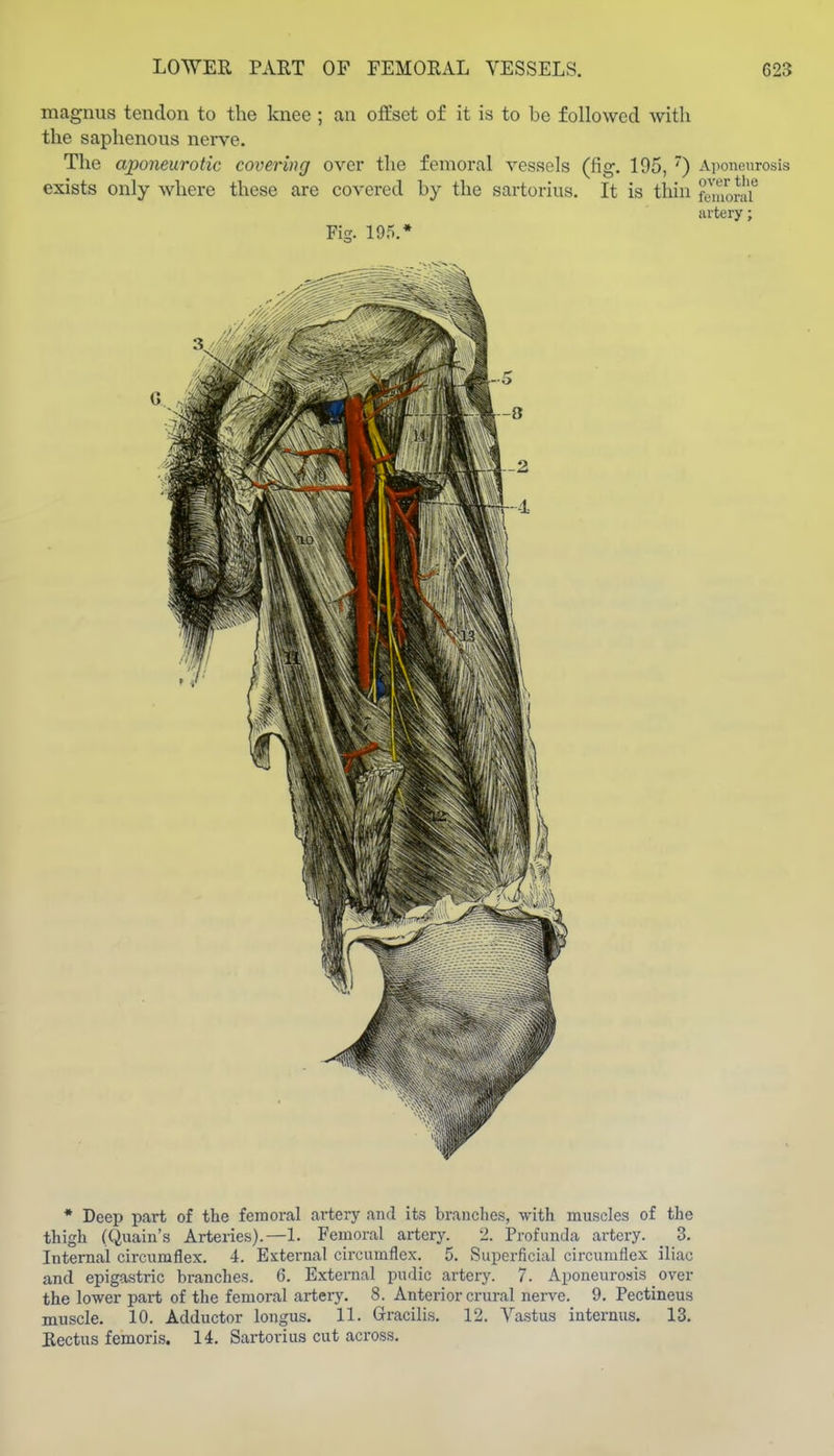 magnus tendon to the knee ; au offset of it is to be followed with the saphenous nerve. The aponeurotic covering ovei* the femoral vessels (fig. 195, ) Aponeurosis exists only where these are covered by the sartorius. It is thin ftnuorai artery; Fig. 195.* * Deep part of the femoral artery and its branches, with muscles of the thigh (Quain's Arteiies).—1. Femoral artery. 2. Profunda artery. _ 3. Internal circumflex. 4. External circumflex. 5. Superficial circumflex iliac and epigastric branches. 6. External pudic artery. 7. Aponeurosis over the lower part of the femoral artery. 8. Anterior crural nen^e. 9. Pectineus muscle. 10. Adductor longus. 11. Gracilis. 12. Vastus internus. 13. Rectus femoris. 14, Sartorius cut across.