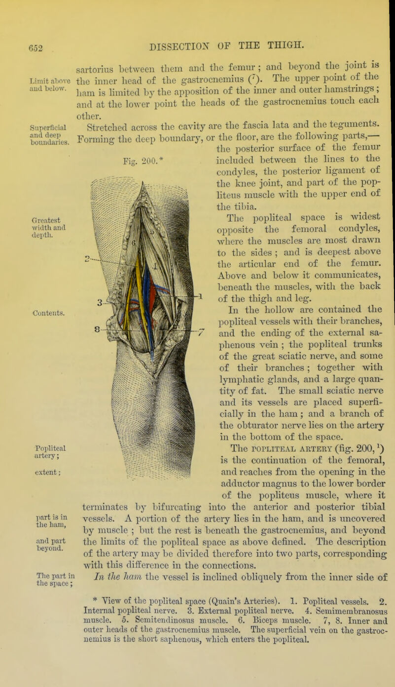 Limit aliove iiud below. Superficial .ind deep boundai-ies. Greatest width and deptli. Contents. Popliteal artery; extent: ]\art is in the ham, and part beyond. The part in tlie space; Fig. 200.' sartorius between them and tlie femur; and bej^ond the jonit is the inner head of the gastrocnemius (')• The upper point of the ham is hmitcd by the apposition of the inner and outer hamstrmgs ; and at the lower point the heads of the gastrocnemius touch each other. Stretched across the cavity are the fascia lata and the teguments. Forming the deep boundary, or the floor, are the follo^\^ng parts,— the posterior surface of the femur included between the lines to the condyles, the posterior ligament of the knee joint, and part of the pop- hteus nmscle with the upper end of the tibia. The popliteal space is widest opposite the femoral condyles, where the muscles are most drawn to the sides ; and is deepest above the articular end of the femur. Above and below it communicates, beneath the muscles, with the back of the thigh and leg. In the hollow are contained the popliteal vessels with their branches, and the ending of the external sa- phenous vein ; the popliteal trunks of the great sciatic nen^e, and some of their branches; together with lymphatic glands, and a large quan- tity of fat. The small sciatic nerve and its vessels are placed superfi- cially in the ham; and a branch of the obturator nerve lies on the arteiy in the bottom of the space. The roPLiTEAL artery (fig. 200, ^) is the continuation of the femoral, and reaches from the opening in the adductor magnus to the lower border of the popliteus muscle, where it terminates by bifurcating into the anterior and posterior tibial vessels. A portion of the artery lies in the ham, and is uncovered by muscle ; but the rest is beneath the gastrocnemius, and beyond the limits of the popliteal space as above defined. The description of the artery may be divided therefore into two parts, corresponding with tliis difference in the connections. In the ham the vessel is inclined obliquety from the inner side of * View of the popliteal space (Quain's Arteries). 1. Popliteal vessels. 2. Intemal popliteal nerve. 3. External popliteal nerve. 4. Semimerabranosus muscle. 5. Scmitendinosus muscle. 6. Biceps muscle. 7, 8. Inner and outer heads of the gastrocnemius muscle. The superficial vein on the gastroc- nemius is the short saphenous, which enters the popliteal.