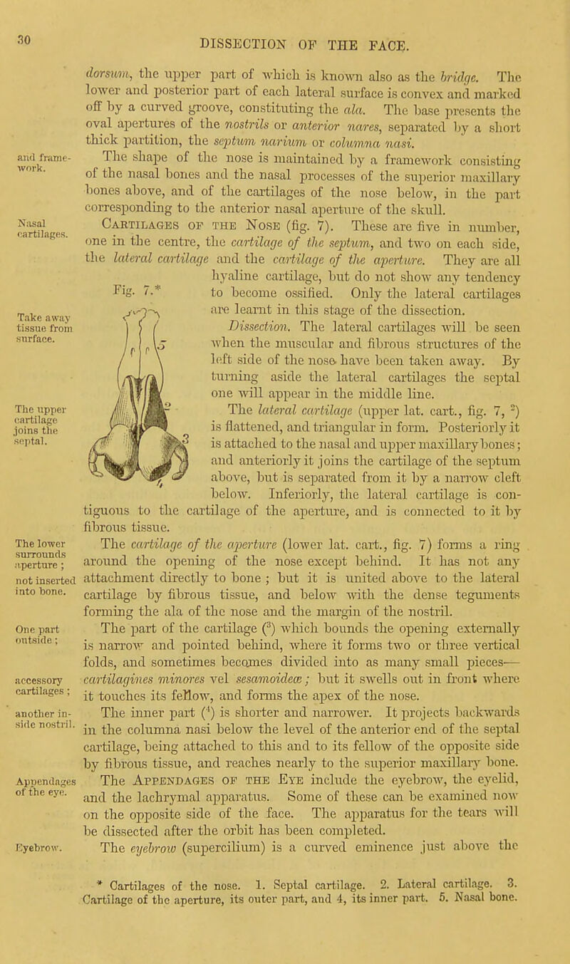 aiul frame- work. Nasal cartilages. Take away tissue i'rom surface. The upper cartilage joins the septal. The lower surrounds aperture ; not inserted into bone. One part outside : accessory cartilages ; another in- side nostril. Appendages of the eye. Eyebrow. dorsym, the upper part of which is known also as the bridge. The lower and posterior part of each lateral surface is convex and marked off by a curved groove, constituting the ala. The base presents the oval apertures of the nostrils or anterior nares, separated by a short thick partition, the scptwm narivm or columna nasi. The shape of the nose is maintained by a framework consisting of the nasal bones and the nasal processes of the superior maxillary bones above, and of the cartilages of the nose below, in the part corresponding to the anterior nasal aperture of the skull. Cartilages of the Nose (fig. 7). These are five in number, one in the centre, the cartilage of the septum, and two on each side, the lateral cartilage and the cartilage of the aperture. They are all hyaline cartilage, but do not show any tendency to become ossified. Only the lateral cartilages are learnt in this stage of the dissection. Dissection. The lateral cartilages will be seen when the muscular and fibrous structures of the left side of the nose, have been taken away. By l nming aside the lateral cartilages the septal one will appear in the middle line. The lateral cartilage (upper lat. cart., fig. 7, 2) is flattened, and triangular in form. Posteriorly it is attached to the nasal and upper maxillary bones; and anteriorly it joins the cartilage of the septum above, but is separated from it by a narrow cleft below. Inferiorly, the lateral cartilage is con- tiguous to the cartilage of the aperture, and is connected to it by fibrous tissue. The cartilage of the aperture (lower lat. cart., fig. 7) forms a ring around the opening of the nose except behind. It has not any attachment directly to bone ; but it is united above to the lateral cartilage by fibrous tissue, and below with the dense teguments forming the ala of the nose and the margin of the nostril. The part of the cartilage (3) which bounds the opening externally is narrow and pointed behind, where it forms two or three vertical folds, and sometimes becomes divided into as many small pieces— cartilagines minores vel sesamoidea; but it swells out in front where it touches its fellow, and forms the apex of the nose. The inner part (') is shorter and narrower. It projects backwards in the columna nasi below the level of the anterior end of the septal cartilage, being attached to this and to its fellow of the opposite side by fibrous tissue, and reaches nearly to the superior maxillary bone. The Appendages of the Eye include the eyebrow, the eyelid, and the lachrymal apparatus. Some of these can be examined now on the opposite side of the face. The apparatus for the tears will be dissected after the orbit has been completed. The eyebrow (supercilium) is a curved eminence just above the * Cartilages of the nose. 1. Septal cartilage. 2. Lateral cartilage. 3. Cartilage of the aperture, its outer part, and 4, its inner part. 5. Nasal bone.