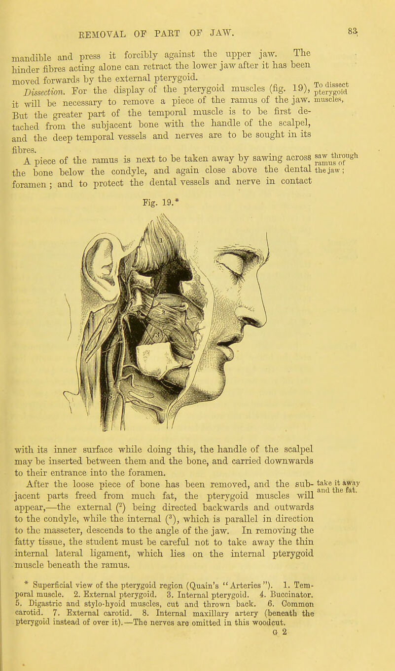 mandible and press it forcibly against the upper jaw. The hinder fibres acting alone can retract the lower jaw after it has been moved forwards by the external pterygoid. Todissect Dissection. For the display of the pterygoid muscles (ng. 19), pterygoid it will be necessary to remove a piece of the ramus of the jaw. muscles, But the greater part of the temporal muscle is to be first de- tached from the subjacent bone with the handle of the scalpel, and the deep temporal vessels and nerves are to be sought in its fibres. A piece of the ramus is next to be taken away by sawing across ^utshJ°u«h the bone below the condyle, and again close above the dental the jaw; foramen ; and to protect the dental vessels and nerve in contact Fig. 19.* with its inner surface while doing this, the handle of the scalpel may be inserted between them and the bone, and carried downwards to their entrance into the foramen. After the loose piece of bone has been removed, and the sub- Jj^e jt^awjiy jacent parts freed from much fat, the pterygoid muscles will appear,—the external (2) being directed backwards and outwards to the condyle, while the internal (3), which is parallel in direction to the rnasseter, descends to the angle of the jaw. In removing the fatty tissue, the student must be careful not to take away the thin internal lateral ligament, which lies on the internal pterygoid muscle beneath the ramus. * Superficial view of the pterygoid region (Quain's Arteries). 1. Tem- poral muscle. 2. External pterygoid. 3. Internal pterygoid. 4. Buccinator. 5. Digastric and stylo-hyoid muscles, cut and thrown back. 6. Common carotid. 7. External carotid. 8. Internal maxillary artery (bcneatb the pterygoid instead of over it).—The nerves are omitted in this woodcut. o 2