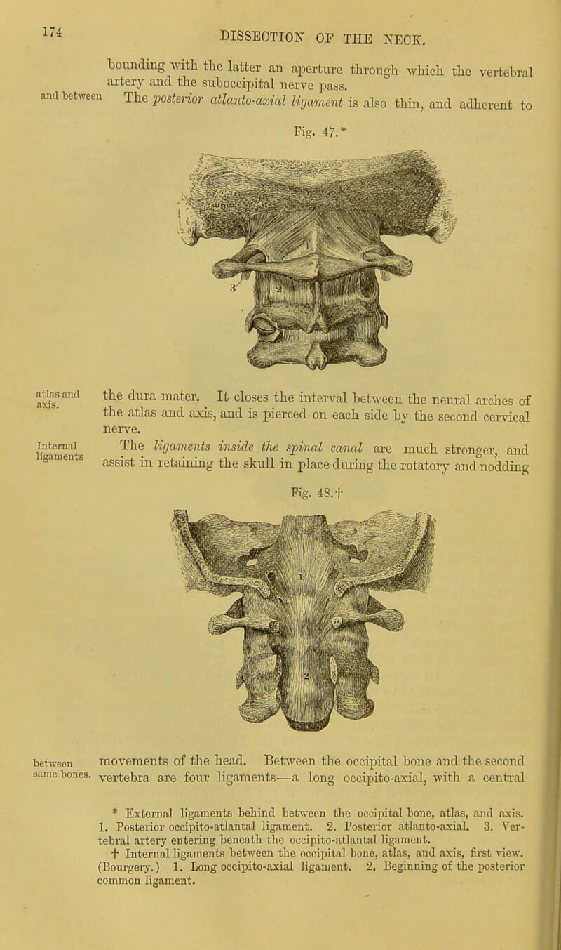 bounding with the latter an aperture through winch the vertebral artery and the suboccipital nerve pass, and between The posterior atlanto-axial ligament is also thin, and adherent to Fig. 47.* atlas and the dura mater. _ It closes the interval between the neural arches of the atlas and axis, and is pierced on each side by the second cervical nerve. Internal The ligaments inside the spinal canal are much stronger, and gamen s asgigt ^ j^gj^g ^Q pjace ^llImg tjie rotat0ry and nodding Fig. 48.+ between movements of the head. Between the occipital bone and the second same bones, vertebra are four ligaments—a long occipito-axial, with a central * External ligaments behind between the occipital bone, atlas, and axis. 1. Posterior occipito-atlantal ligament. 2. Posterior atlanto-axial. 3. Ver- tebral artery entering beneath the occipito-atlantal ligament. + Internal ligaments between the occipital bone, atlas, and axis, first view. (Bourgery.) 1. Long occipito-axial ligament. 2. Beginning of the posterior common ligament.