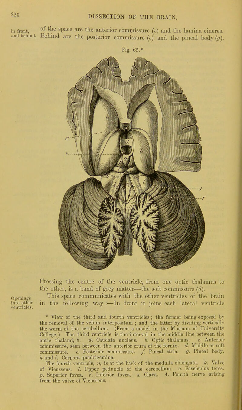 tu front, of tlie sPace are anterior commissure (c) and the lamina cinerea. and behind. Behind are the posterior commissure (e) and the pineal body (</). Fig. 65.* Crossing the centre of the ventricle, from one optic thalamus to the other, is a band of grey matter—the soft commissure (d). Openings This space communicates with the other ventricles of the brain into other in the following way :—In front it joins each lateral ventricle ventricles. o j j * View of the third and fourth ventricles ; the former being exposed by the removal of the velum interpositum ; and the latter by dividing vertically the worm of the cerebellum. (From a model in the Museum of University College.) The third ventricle is the interval in the middle line between the optic thalami, 6. a. Caudate nucleus, b. Optic thalamus. c. Anterior commissure, seen between the anterior crura of the fornix, d. Middle or soft commissure. e. Posterior commissure. /. Pineal stria, g. Pineal body. k and i. Corpora quadrigcmina. The fourth ventricle, n, is at the back of the medulla oblongata, It. Valve of Vieussens. I. Upper peduncle of the cerebellum, o. Fasciculus teres. p. Superior fovea, f. Inferior fovea, s. Clava. 4. Fourth nerve arising from the valve of Vieussens.