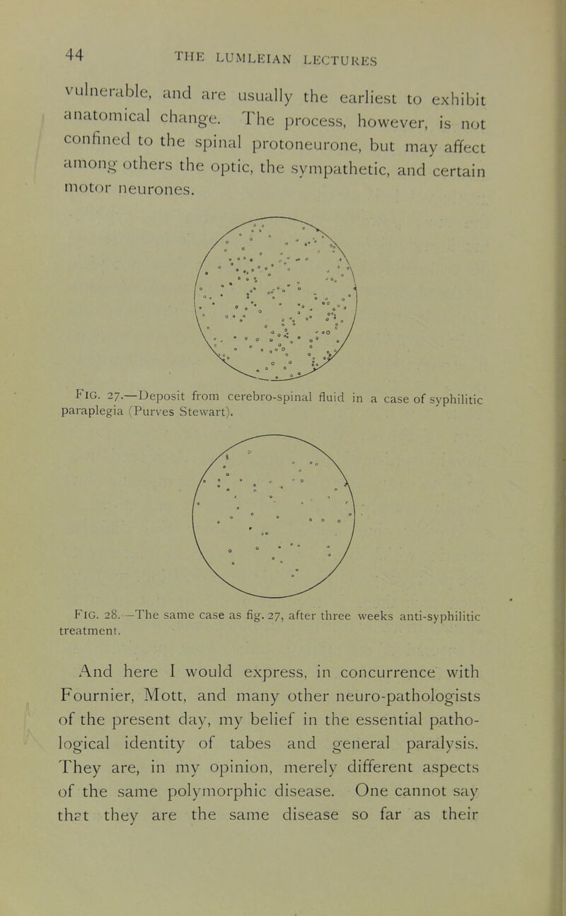 vulnerable, and are usually the earliest to exhibit anatomical change. The process, however, is not confined to the spinal protoneurone, but may affect among- others the optic, the sympathetic, and certain motor neurones. FIG. 27.—Deposit from cerebro-spinal fluid in a case of syphilitic paraplegia (Purves Stewart). Fig. 28. -The same case as fig. 27, after three weeks anti-syphilitic treatment. And here I would express, in concurrence with Fournier, Mott, and many other neuro-pathologists of the present day, my belief in the essential patho- logical identity of tabes and general paralysis. They are, in my opinion, merely different aspects of the same polymorphic disease. One cannot say th?t they are the same disease so far as their