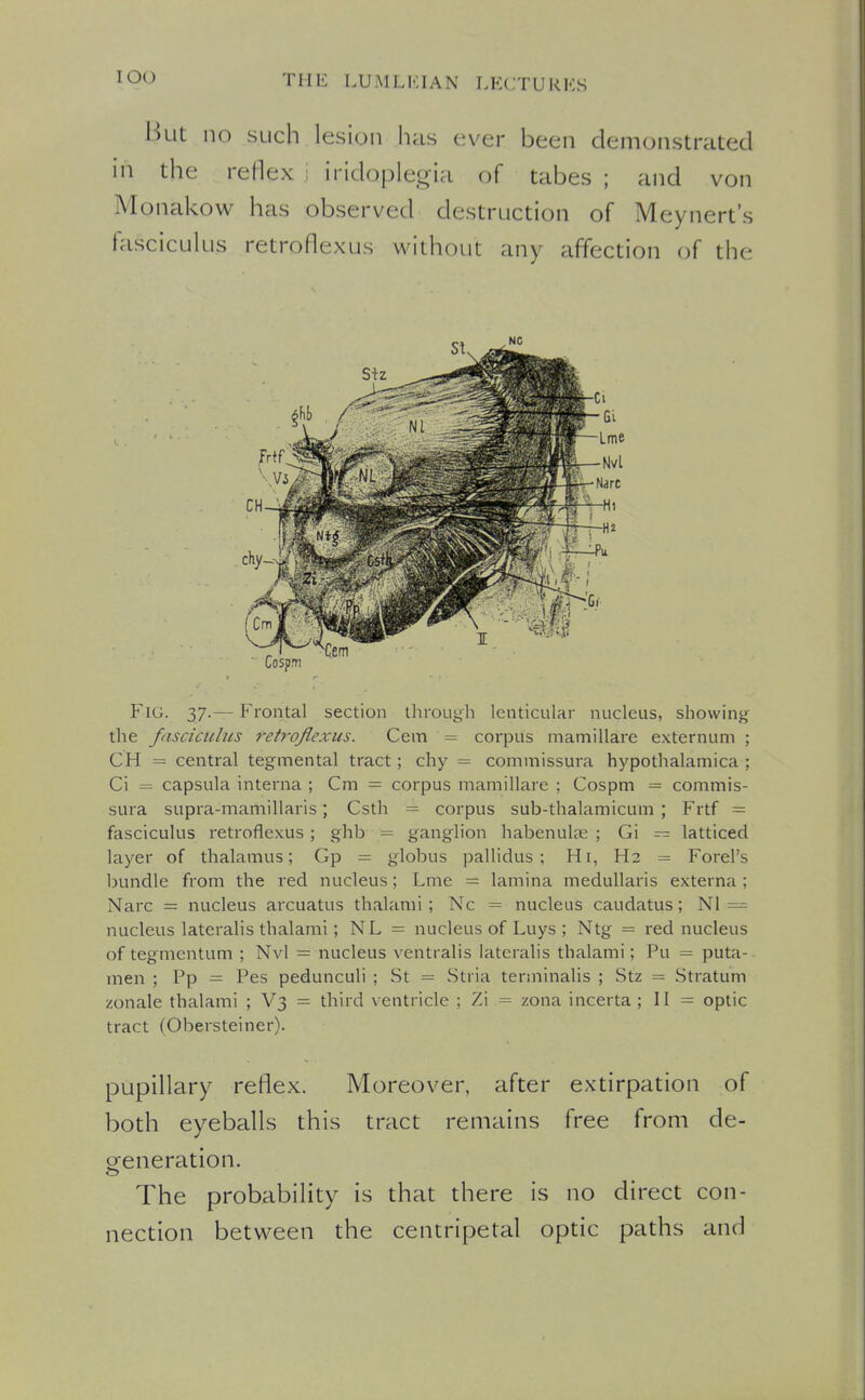 But no such lesion has ever been demonstrated in the reflex i iridoplegia of tabes ; and von Monakow has observed destruction of Meynert's fasciculus retroflexus without any affection of the Fig. 37.— Frontal section through lenticular nucleus, showing the fasciculus ret7-oJlexus. Cem = corpus mamillare externum ; CH = central tegmental tract; chy = commissura hypothalamica ; Ci = capsula interna ; Cm = corpus mamillare ; Cospm = commis- sura supra-mamillaris; Csth = corpus sub-thalamicum ; Frtf = fasciculus retroflexus; ghb = ganglion habenuhis ; Gi — latticed layer of thalamus; Gp = globus pallidus ; Hi, H2 = Forel's bundle from the red nucleus; Lme = lamina medullaris externa ; Narc = nucleus arcuatus thalami ; Nc = nucleus caudatus; Nl — nucleus lateralis thalami; NL = nucleus of Luys ; Ntg = red nucleus of tegmentum ; Nvl = nucleus ventralis lateralis thalami; Pu = puta- men ; Pp — Pes pedunculi ; St = Stria terminalis ; Stz = Stratum zonale thalami ; V3 = third ventricle ; Zi = zona incerta ; II = optic tract fObersteiner). pupillary reflex. Moreover, after extirpation of both eyeballs this tract remains free from de- ofeneration. The probability is that there is no direct con- nection between the centripetal optic paths and