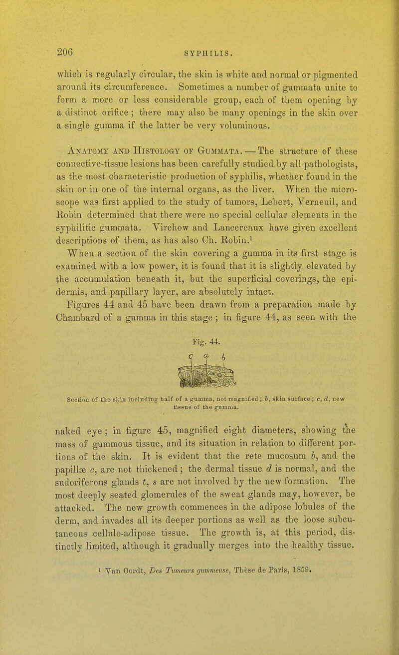 which is regularly cii'cular, the skin is white and normal or pigmented around its circumference. Sometimes a number of gummata unite to form a more or less considerable group, each of them opening by a distinct orifice ; there may also be many openings in the skin over a single gumma if the latter be very voluminous. Anatomy and Histology op Gummata. — The structure of these connective-tissue lesions has been carefully studied by all pathologists, as the most characteristic production of syphilis, whether found in the skin or in one of the internal organs, as the liver. When the micro- scope was first applied to the study of tumors, Lebert, Verneuil, and Robin determined that there were no special cellular elements in the syphilitic gummata. Virchow and Lancereaux have given excellent descriptions of them, as has also Ch. Robin.^ When a section of the skin covering a gumma in its first stage is examined with a low power, it is found that it is slightly elevated by the accumulation beneath it, but the superficial coverings, the epi- dermis, and papillary layer, are absolutely intact. Figures 44 and 45 have been drawn from a preparation made by Charabard of a gumma in this stage ; in figure 44, as seen with the Section of the skin including half of a gumma, not magnified ; 6, skin surface ; c, d, new tisMue of the gninrua. naked eye ; in figure 45, magnified eight diameters, showing t^ie mass of gummous tissue, and its situation in relation to different por- tions of the skin. It is evident that the rete mucosum b, and the papillae c, are not thickened; the dermal tissue d is normal, and the sudoriferous glands t, s are not involved by the new formation. The most deeply seated glomerules of the sweat glands may, however, be attacked. The new groAvth commences in the adipose lobules of the derm, and invades all its deeper portions as well as the loose subcu- taneous cellulo-adipose tissue. The growth is, at this period, dis- tinctly limited, although it gradually merges into the healthy tissue. ' Van Oordt, Des Tvmeurs gummettse, Tli6se de Paris, 1859.