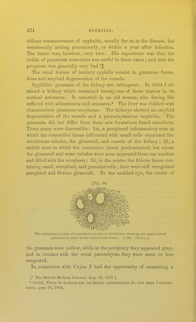 siclious commencement of nephritis, usually far on in the disease, but occasionally arising precociously, or within a year after infection. The latter was, however, very rare. His experience was that the iodide of potassium sometimes was useful in these cases ; and that the prognosis was generally very bad.'] The renal lesions of tertiary syphilis consist in gummous forma- tions and amyloid degeneration of the vessels. Syphilitic gummata of the kidney are infrequent. In 18G4 I ob- tained a kidney which contained twenty-one of these tumors in its cortical substance. It occurred in an old woman, who during life suffered with albuminuria and anasarca.^ The liver was riddled with characteristic gummous neoplasms. The kidneys shoAved an amyloid degeneration of the vessels and a parenchymatous nephritis. The gummata did not differ from these new formations found elsewhere. Three zones were discernible: 1st, a peripheral inflammatory zone in which the connective tissue infiltrated with small cells separated the uriniferous tubules, the glomeruli, and vessels of the kidney ; 2d, a middle zone in which the connective tissue predominated, but where tbe glomeruli and some tubules were seen separated from one another and filled with the neoplasm ; 3d, in the centre the fibrous tissue con- taining small, atrophied, and granular cells ; here were still recognized atrophied and fibrous glomeruli. To the unaided eye, the centre of •[Fig. 84. The peripheral portion of a gummous growth iu the Icidnoy, showing tho amall-ceUed granulation tissue in the intertubular tissiio. X 200. (Green)] the gummata were yellow, while at the periphery they appeared gray, and in contact with the renal parenchyma they were more or less congested. In connection with Coyne I had the opportunity of examining a ['■ The Britisli Medical .Journal, Aug. 23, 1879.] ' Cornil, These de doctorat sur les 16sions anatomiques du rein dans I'albumi- nurie, page 50, 18G4.