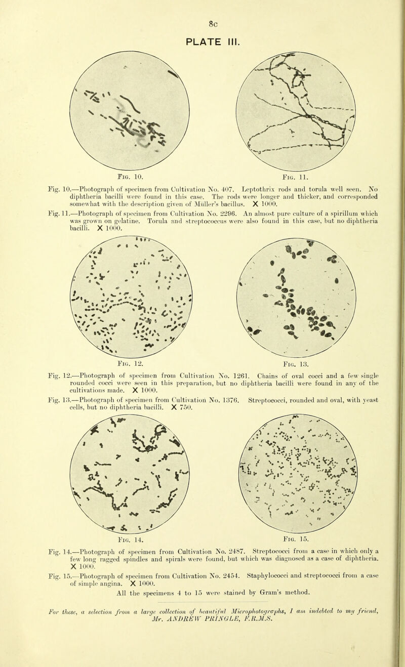 8c PLATE III. Fig. 10. Fig. 11. Fig. 10.—Photograph of specimen from Cultivation No. 407. Leptothrix rods and torula well seen. No diphtheria bacilli were found in this case. The rods were longer and thicker, and corresponded somewhat with the description given of Miiller's bacillus. X 1000. Fig. 11.—Photograph of specimen from Cultivation No. 2296. An almost pure culture of a spirillum which was grown on gelatine. Torula and streptococcus were also found in this case, but no diphtheria bacilli. X 1000. Fig. 12. Fig. 13. Fig. 12.—Photograph of specimen from Cultivation No. 1261. Chains of oval cocci and a few single rounded cocci were seen in this preparation, but no diphtheria bacilli wei-e found in any of the cultivations made. X 1000. Fig. 13.—Photograph of specimen from Cultivation No. 1376. Streptococci, rounded and oval, vvith yeast cells, but no diphtheria bacilli. X 750. Fig. 14. Fig. 15. Fig. 14.—Photograph of specimen from Cultivation No. 2487. Streptococci from a case in which only a few long ragged spindles and spirals were found, but which was diagnosed as a case of diphtheria. X 1000. Fig. 15.—Photograph of specimen from Cultivation No. 2454. Staphylococci and streptococci from a case of simple angina. X 1000. All the specimens 4 to 15 were stained by Gram's method. For these, a selection from a large collection of heautiful Microphotoffrcphs, 1 am indebted to my friend, Mr. ANBRkW PRINGLE, F.K.M.S.