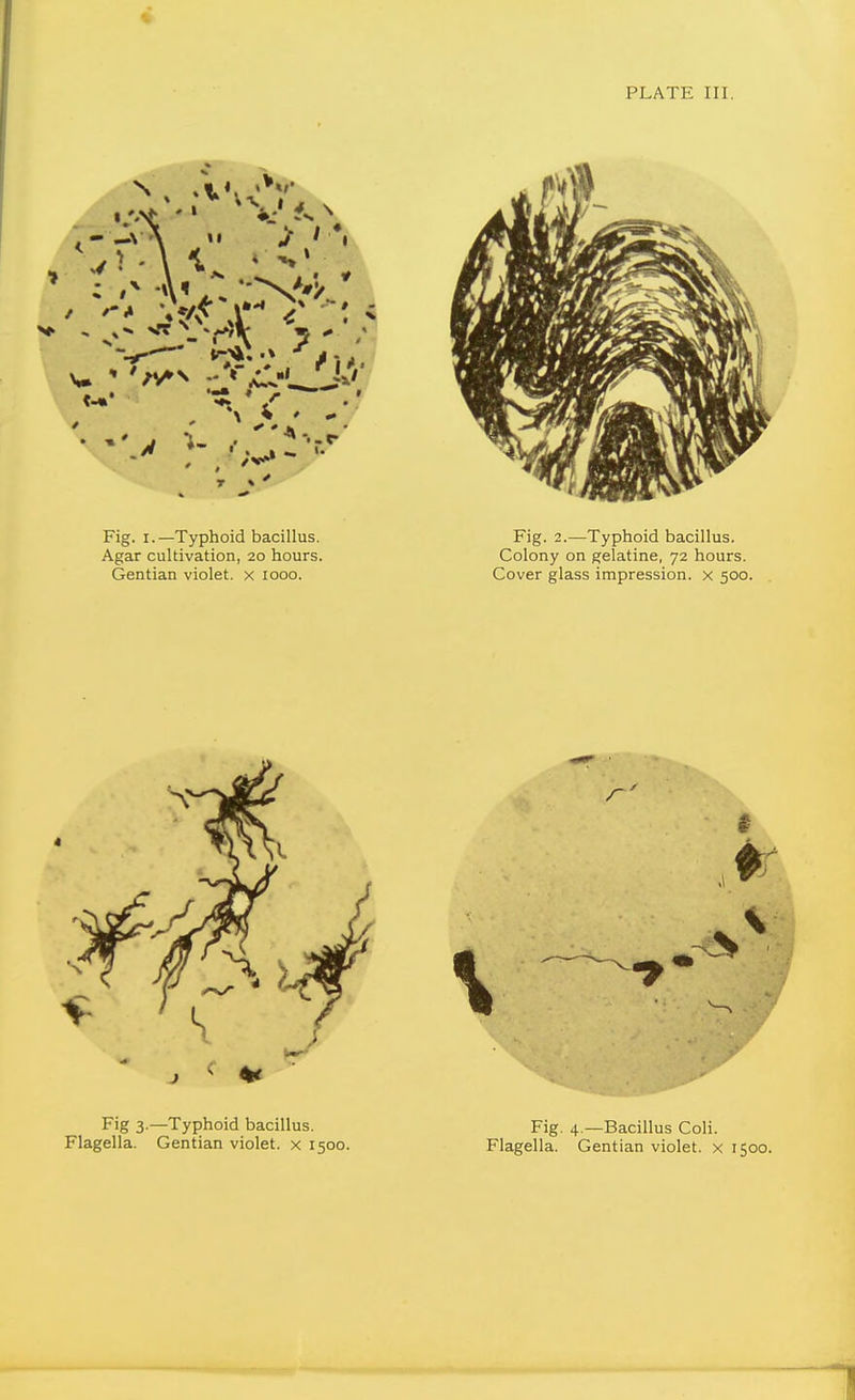 PLATE III. Fig. I.—Typhoid bacillus. Agar cultivation, 20 hours. Gentian violet, x 1000. Fig. 2.—Typhoid bacillus. Colony on gelatine, 72 hours. Cover glass impression, x 500.