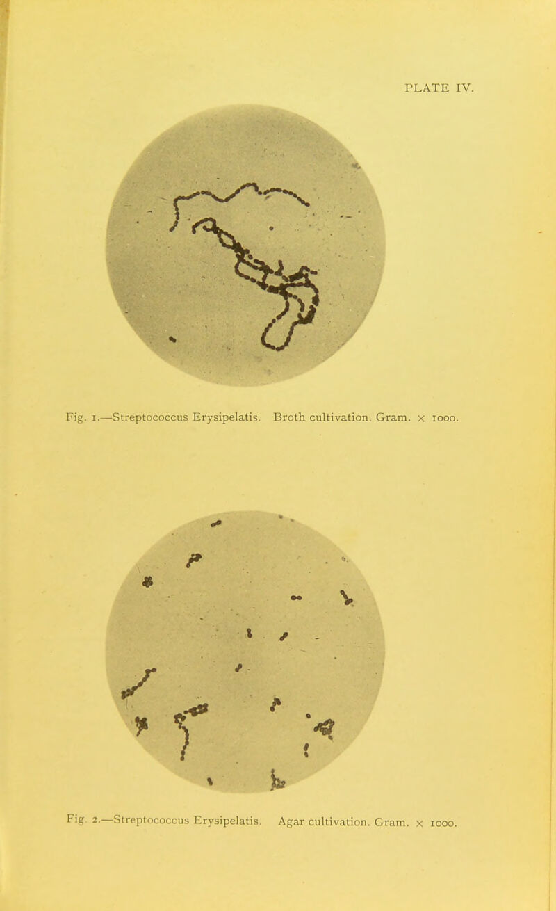 Fig. 2.—Streptococcus Erysipelatis. Agar cultivation. Gram, x looo.