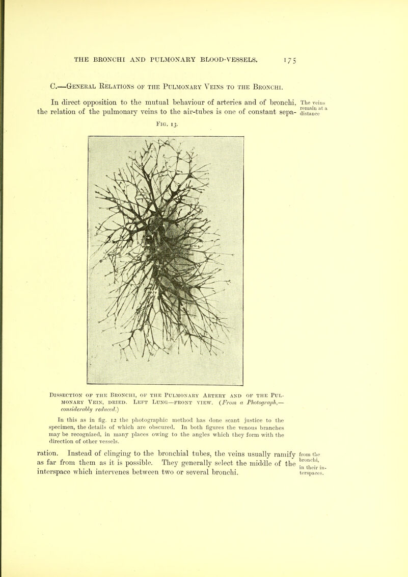 C.—General Relations of the Pulmonary Veins to the Bronchi. In direct opposition to the mutual betaviour of arteries and of bronchi, The yeius the relation of the pulmonary veins to the air-tubes is one of constant sepa- distance^'' Fig. 13. Dissection op the Beonchi, or the Pulmonaey Aeteey and of the Pul- monary Vein, dried. Left Lung—feont view. {From a Fhotograjjh,— considerably reduced.) Ill this as in fig, 12 the photographic method has clone scant justice to the specimen, the details of which are obscured. In both figures the venous branches may be recognized, in many places owing to the angles which they form with the direction of other vessels. ration. Instead of clinging to the bronchial tubes, the veins usually ramify from tiie as far from them as it is possible. They generally select the middle of the ['^tbt'''- interspace which intervenes between two or several bronchi, terspaces.