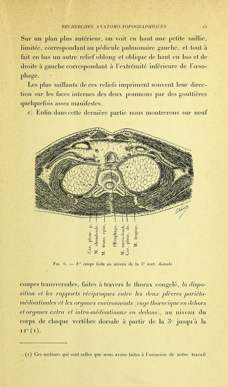 Sur un plan plus antérieur, on voit en haut une petite saillie, limitée, correspondant au pédicule pulmonaire gauche, et tout à fait en bas un autre relief oblong et oblique de haut en bas et de droite à gauche correspondant à l'extrémité inférieure de l'œso- phage. Les plus saillants de ces reliefs impriment souvent leur direc- tion sur les faces internes des deux poumons par des gouttières cmelquefois assez manifestes. c) Enfui dans celte dernière partie nous montrerons sur neuf Fig. 6. — I-' coupe faite au niveau de la 3° vert, dorsale. coupes transversales, faites à travers le thorax congelé, la dispo- sition el les rapports réciproques entre les deux plèvres pariéto- médiastinales el les organes environnants (cage thoracique en dehors el organes extra et intra-médiastinaux en dedans), au niveau du corps de chaque vertèbre dorsale à partir de la 3° jusqu'à la ir(i). (i) Ces sections qui sont celles que nous avons laites à l'occasion de notre travail