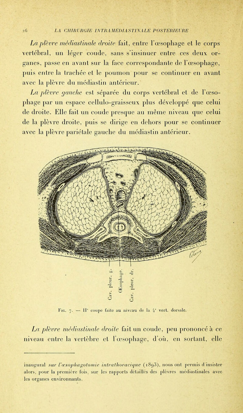 La plèvre médiastinale droite fait, entre l'œsophage et le corps vertébral, un léger coude, sans s'insinuer entre ces deux, or- ganes, passe en avant sur la face correspondante de l'œsophage, puis entre la trachée et le poumon pour se continuer en avant avec la plèvre du médiastin antérieur. La plèvre gauche est séparée du corps vertébral et de l'œso- phage par un espace cellulo-graisseux plus développé cpie celui de droite. Elle fait un coude presque au même niveau que celui de la plèvre droite, puis se dirige en dehors pour se continuer avec la plèvre pariétale gauche du médiastin antérieur. rj 7? £ O . ez > Fig. 7. — 11° coupe failo au niveau de la 4° vert, dorsale. La plèvre médiastinale droite fait un coude, peu prononcé à ce niveau entre la vertèbre et 1 œsophage, d'où, en sortant, elle inaugural sur L'œsophagotomie intrathoracique (1890), nous ont permis d insister alors, pour la première fois, sur les rapports détaillés des plèvres médiastinales avec les organes environnants.