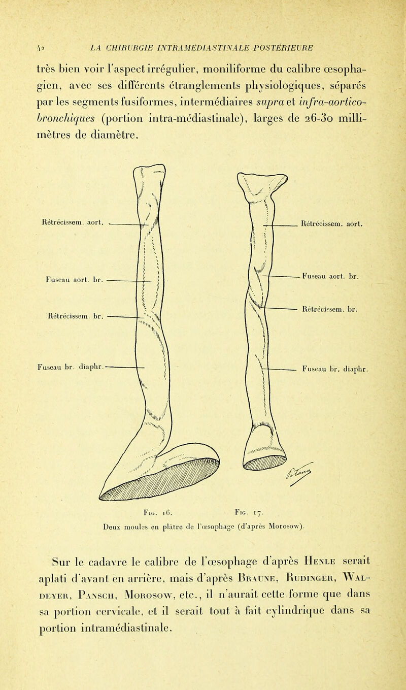 très bien voir l'aspect irrégulier, moniliforme du calibre œsopha- gien, avec ses différents étranglements physiologiques, séparés parles segments fusiformes, intermédiaires supra et infra-aortico- bronchiques (portion intra-médiastinale), larges de 26-3o milli- mètres de diamètre. Fig. Fig. 17. Deux moules en plàlre de l'œsophage (d'après Morosow). Sur le cadavre le calibre de l'œsophage d'après Henle serait aplati d'avant en arrière, mais d'après Braune, Rudinger, Wal- deyer, Paxsch, Mouosow, etc., il n'aurait celle forme que dans sa portion cervicale, et il serait tout à fait cylindrique dans sa portion inlramédiaslinale.