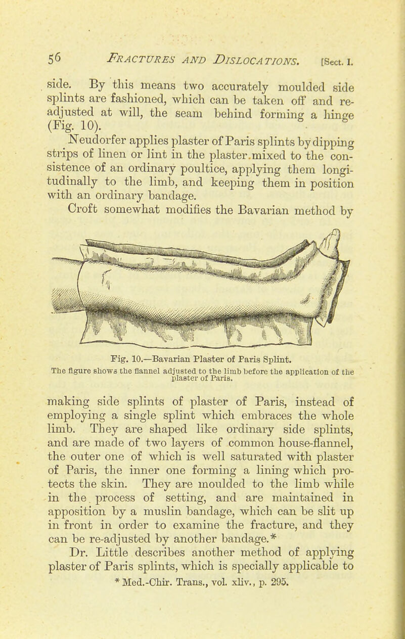 side. By this means two accurately moulded side splints are fashioned, which can be taken off and re- adjusted at will, the seam behind forming a hinge (Fig. 10). ^ JSTeudorfer applies plaster of Paris splints by dipping strips of linen or lint in the plaster.mixed to the con- sistence of an ordinary poultice, applying them longi- tudinally to the limb, and keeping them in position with an ordinaiy bandage. Croft somewhat modifies the Bavarian method by Fig. 10.—Bavarian Plaster of Paris Splint. The figure shows the flannel adjusted to the limb hefore the application of the plaster of Paris. making side splints of plaster of Paris, instead of employing a single splint which embraces the whole limb. They are shaped like ordinary side splints, and are made of two layers of common house-flannel, the outer one of which is well saturated with plaster of Paris, the inner one forming a lining which pro- tects the skin. They are moulded to the limb while in the. process of setting, and are maintained in apposition by a muslin bandage, which can be slit up in front in order to examine the fracture, and they can be re-adjusted by another bandage.* Dr. Little describes another method of applying plaster of Paris splints, which is specially applicable to *Med.-Chir. Trans., vol. xliv., p. 295.