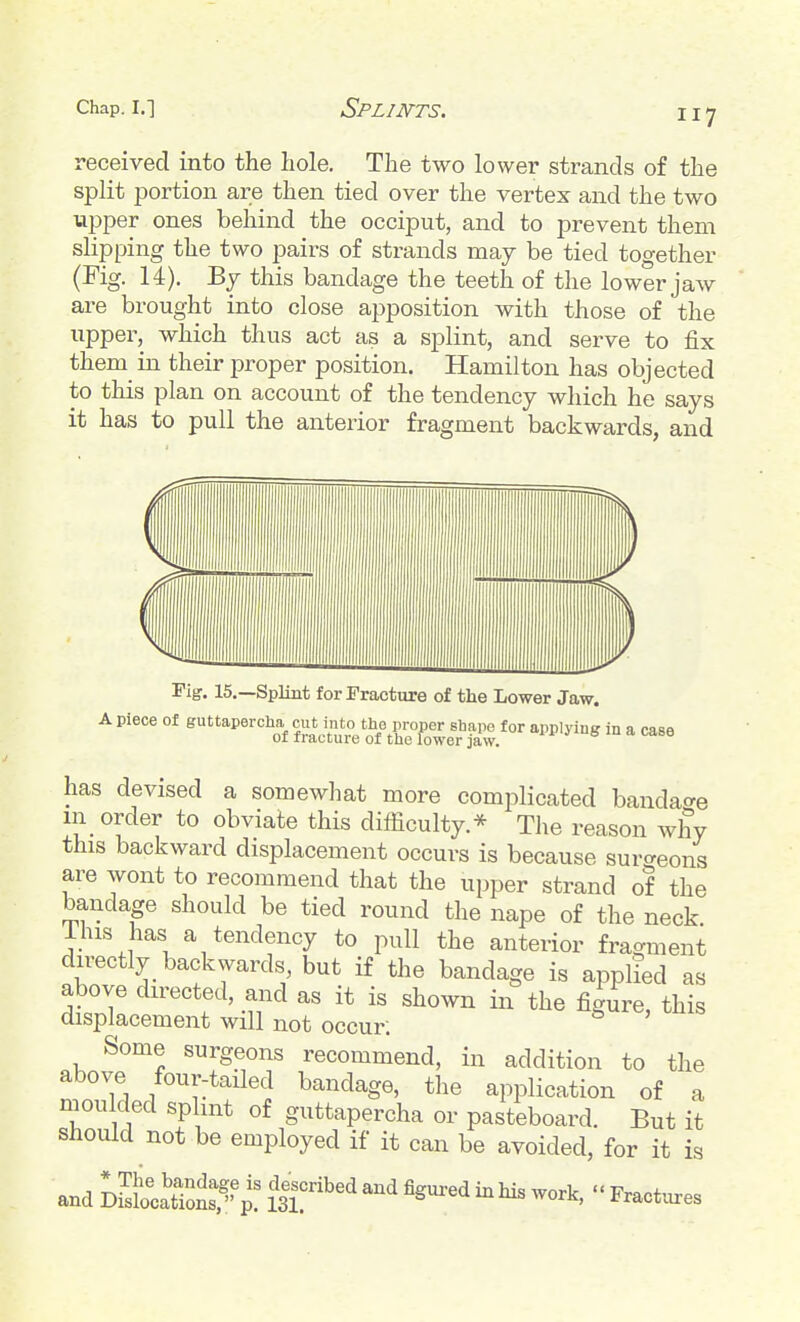 received into the hole. The two lower strands of the split portion are then tied over the vertex and the two upper ones behind the occiput, and to prevent them slipping the two pairs of strands may be tied together (Fig. 14). Bj this bandage the teeth of the lower jaw are brought into close apposition with those of the upper, which thus act as a splint, and serve to fix them in their proper position. Hamilton has objected to this plan on account of the tendency which he says it has to pull the anterior fragment backwards, and Tig. 15.—Splint for Fracture of the Lower Jaw. Apiece of guttapercha cut into the proper shape for applying in a case of fracture of the lower jaw. ^ ^ has devised a somewhat more complicated bandacre in order to obviate this difficulty.* The reason why this backward displacement occurs is because surc^eons are wont to recommend that the upper strand of the bandage should be tied round the nape of the neck i his has a tendency to pull the anterior fragment directly backwards but if the bandage is applied as above dn-ected, and as it is shown in the figure, this displacement will not occur; Some surgeons recommend, in addition to the above four-tailed bandage, the application of a moulded splmt of guttapercha or pasteboard. But it should not be employed if it can be avoided, for it is and DzloaSotp! ^ 