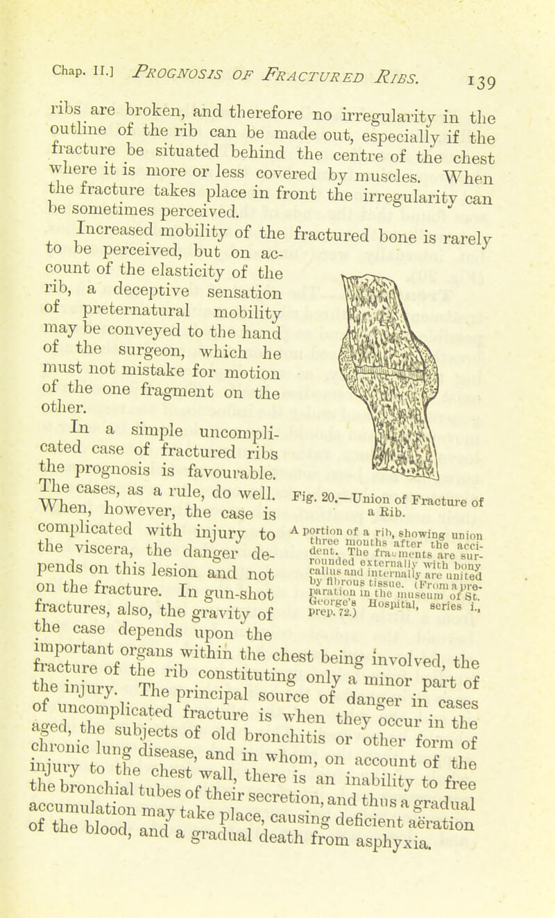 ribs are broken, and tlierefore no irregularity in the outlme of the rib can be made out, especially if the fracture be situated behind the centre of the chest where it is more or less covered by muscles. When the fracture takes place in front the irregularity can be sometimes perceived. Increased mobility of the fractured bone is rarelv to be perceived, but on ac- count of the elasticity of the rib, a deceptive sensation of preternatural mobility may be conveyed to the hand of the surgeon, which he must not mistake for motion of the one fragment on the other. In a simi^le uncompli- cated case of fractured ribs the prognosis is favourable. The cases, as a rule, do well. When, however, the case is complicated with injury to the viscera, the danger de- pends on this lesion and not on the fracture. In gun-shot fractures, also, the gravity of the case depends upon the Srre'oV^r'-r^'^^ ^^i-g ^^-olved, the the *Th. ^^g «-ly a minor pak of tne injury. The principal source of danger in cases *3iood, and a gradual death from asphyxia. Fig. 20.—Union of Fractm-e of a Eib. A portion of a rib, showing union three mouths after the acci- dent. The fi-a.inents are sur- ro nded externally wch bony V flTJ*'' 'iiternally are united by fibrous tissue. (Kroniapre- raiiition in the nuiseuni of St prep!*?!.) ^^l^tal. series i.]