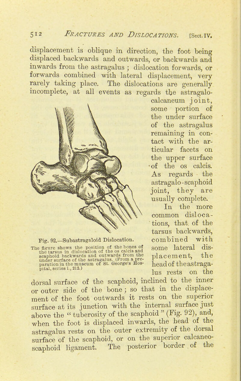 displacement is oblique in direction, the foot being displaced backwards and outwards, or backwards and inwards from the astragalus ; dislocation forwards, or forwards combined with lateral displacement, very rarely taking place. The dislocations are generally incomplete, at all events as regards the astragalo- calcaneum joint, some portion of the under surface of the astragalus remaining in con- tact with the ar- ticular facets on the upper surface •of the OS calcis. As regards the astragalo - scaphoid joint, they are usually complete. In the more common disloca- tions, that, of the tarsus backwards, combined with some lateral dis- placement, the head of the astraga- lus rests on the dorsal surface of the scaphoid, inclined to the inner or outer side of the bone; so that in the displace- ment of the foot outwards it rests on the superior surface at its junction with the internal surface just above the  tuberosity of the scaphoid  (Fig. 92), and, when the foot is displaced inwards, the head of the astragalus rests on the outer extremity of the dorsal surface of the scaphoid, or on the superior calcaneo- scaphoid ligament. The posterior border of the Pig. 92.—Subastragaloid Dislocation. The figure shows the position of the bones of the tarsus in dislocation of the os calcis and scaphoid backwards and outwards from the under surface of the astragalus. (From a pre- paration in the museum of St. George's Hos- pital, series i., 212.)