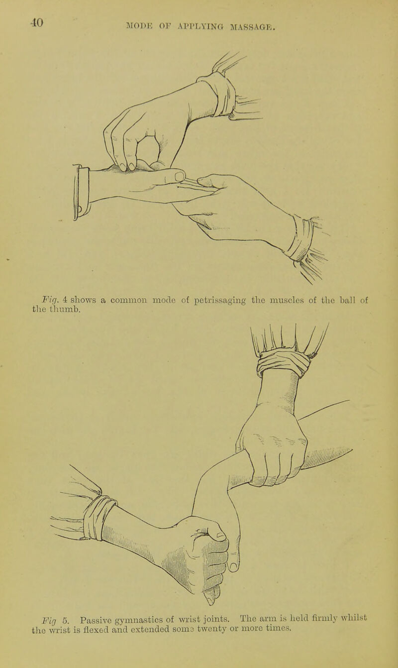 Fig. 4 shows a common mode of petrissaging the muscles of the ball of tlie thumb. Fig 5. Passive gymnastics of wrist joints. The arm is held firmly whilst the wrist is flexed and extended somo twenty or more times.