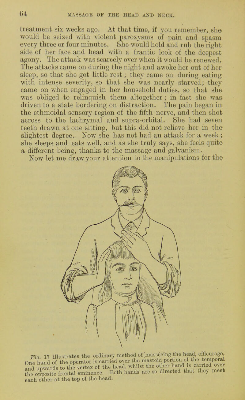 treatment six weeks ago. At that time, if you remember, she would be seized with violent paroxysms of pain and spasm every three or four minutes. She would hold and rub the right side of her face and head with a frantic look of the deepest agony. The attack was scarcely over when it would be renewed. The attacks came on during the night and awoke her out of her sleep, so that she got little rest; they came on during eating with intense severity, so that she was nearly starved; they came on when engaged in her household duties, so that she was obliged to relinquish them altogether ; in fact she was driven to a state bordering on distraction. The pain began in the ethmoidal sensory region of the fifth nerve, and then shot across to the lachrymal and supra-orbital. She had seven teeth drawn at one sitting, but this did not relieve her in the slightest degree. Now she has not had an attack for a week ; she sleeps and eats well, and as she truly says, she feels quite a different being, thanks to the massage and galvanism. Now let me draw your attention to the manipulations for the Win 17 illustrates the ordinary method of >asseeing the head, effleurage One hand of the operator is carried over the mastoid portion of the temporal and upwards to the vertex of the head, whilst the other hand is carried over t^ opp^sHe frontal eminence. Both hands are so directed that they meet each other at the top of the head.
