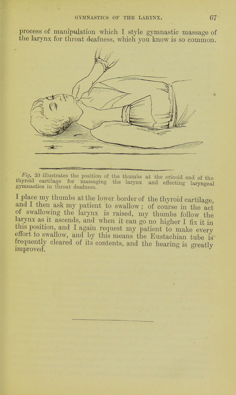 process of manipulation which I style gymnastic massage of the larynx for throat deafness, which you know is so common. Fig 20 illustrates the position of the thumbs at the cricoid end of tho thyroid cartilage for massaging the larynx and effecting laryngeal gymnastics m throat deafness. J ° I place my thumbs at the lower border of the thyroid cartilage and I then ask my patient to swallow ; of course in the act ot swallowing the larynx is raised, my thumbs follow the larynx as it ascends, and when it can go no higher I fix it in this position, and I again request my patient to make every efltort to swallow, and by this means the Eustachian tube is frequently cleared of its contents, and the hearing is greatly improved. J