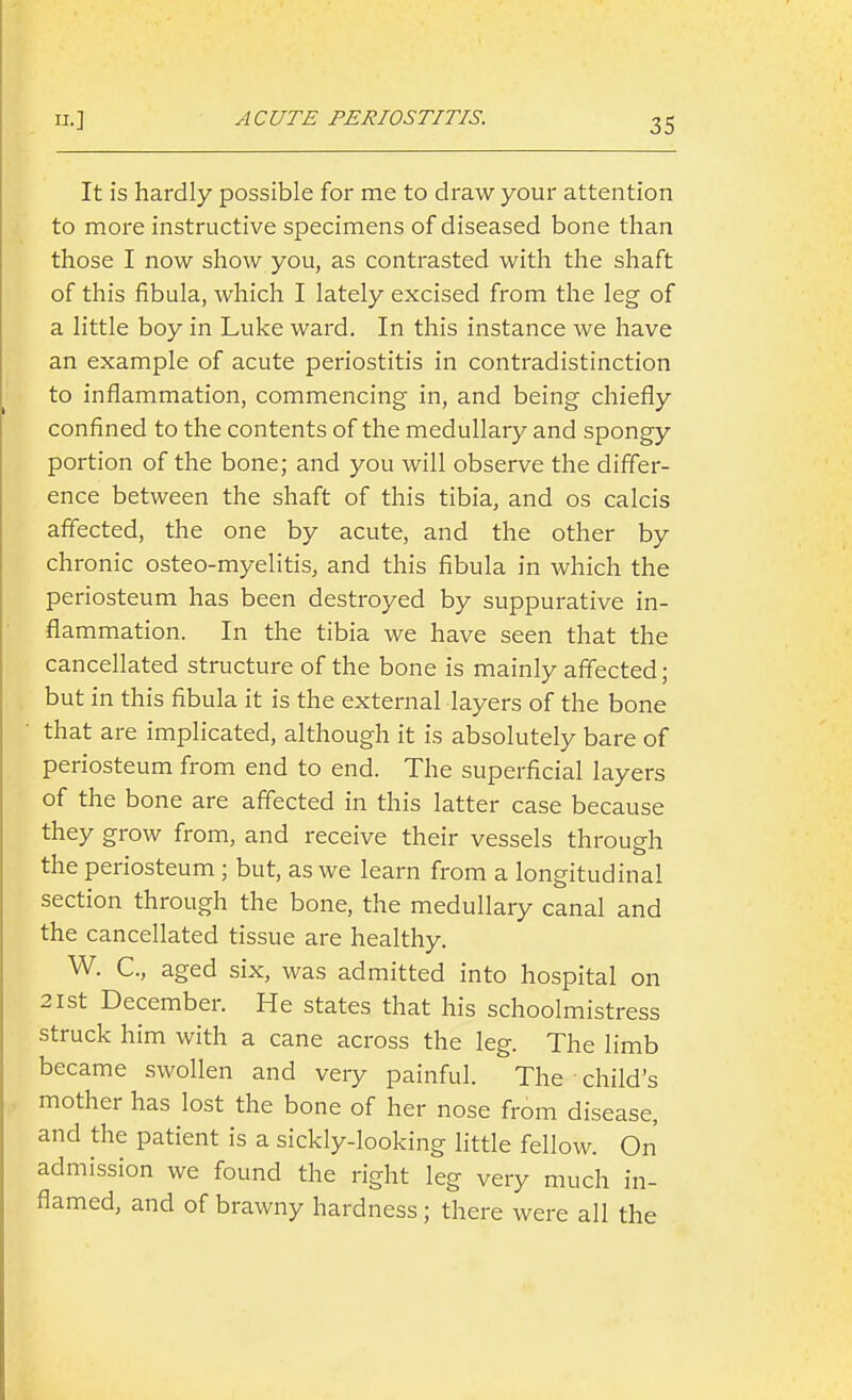 It is hardly possible for me to draw your attention to more instructive specimens of diseased bone than those I now show you, as contrasted with the shaft of this fibula, which I lately excised from the leg of a little boy in Luke ward. In this instance we have an example of acute periostitis in contradistinction to inflammation, commencing in, and being chiefly confined to the contents of the medullary and spongy portion of the bone; and you will observe the differ- ence between the shaft of this tibia, and os calcis affected, the one by acute, and the other by chronic osteo-myelitis, and this fibula in which the periosteum has been destroyed by suppurative in- flammation. In the tibia we have seen that the cancellated structure of the bone is mainly affected; but in this fibula it is the external layers of the bone that are implicated, although it is absolutely bare of periosteum from end to end. The superficial layers of the bone are affected in this latter case because they grow from, and receive their vessels through the periosteum ; but, as we learn from a longitudinal section through the bone, the medullary canal and the cancellated tissue are healthy. W. C, aged six, was admitted into hospital on 21st December. He states that his schoolmistress struck him with a cane across the leg. The limb became swollen and very painful. The child's mother has lost the bone of her nose from disease, and the patient is a sickly-looking little fellow. On admission we found the right leg very much in- flamed, and of brawny hardness; there were all the