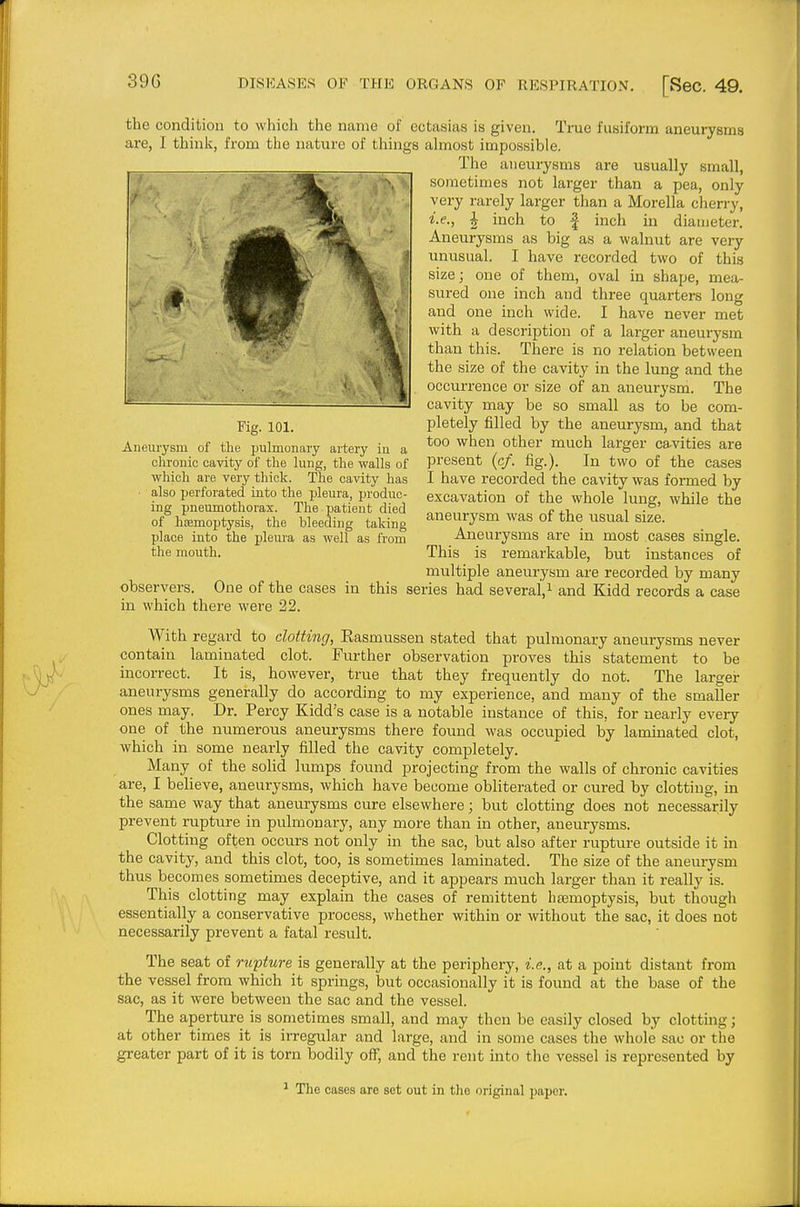the condition to which the name of ectayias is given. True fusiform aneurysms are, I thinlv, from the nature of things almost impossible. The aneurysms are usually small, sometimes not larger than a pea, only very rarely larger than a Morella cheri-y, i.e., I inch to f inch in diameter. Aneurysms as big as a walnut are very unusual. I have recorded two of this size; one of them, oval in shape, mea- sured one inch and three quarters long and one inch wide. I have never met with a description of a larger aneurysm than this. There is no relation between the size of the cavity in the lung and the occurrence or size of an aneurysm. The cavity may be so small as to be com- pletely filled by the aneurysm, and that too when other much larger ca-vities are present (c/. fig.). In two of the cases I have recorded the cavity was formed by excavation of the whole lung, while the aneurysm was of the visual size. Aneurysms are in most cases single. This is remarkable, but instances of multiple aneurysm are recorded by many observers. One of the cases in this series had several',i and Kidd records a case in which there were 22. With regard to clotting, Easmussen stated that pulmonary aneurysms never contain laminated clot. Further observation proves this statement to be incorrect. It is, however, true that they frequently do not. The larger aneurysms generally do according to my experience, and many of the smaller ones may. Dr. Percy Kidd's case is a notable instance of this, for nearly eveiy one of the numerous aneurysms there found was occupied by laminated clot, which in some nearly filled the cavity completely. Many of the solid lumps found projecting from the walls of chronic cavities are, I believe, aneurysms, which have become obliterated or cured by clotting, in the same way that aneurysms cure elsewhere; but clotting does not necessarily prevent rupture in pulmonary, any more than in other, aneurysms. Clotting often occurs not only in the sac, but also after rupture outside it in the cavity, and this clot, too, is sometimes laminated. The size of the aneurysm thus becomes sometimes deceptive, and it appears much larger than it really is. This clotting may explain the cases of remittent lieemoptysis, but though essentially a conservative process, whether within or without the sac, it does not necessarily prevent a fatal result. The seat of rupture is generally at the periphery, i.e., at a point distant from the vessel from which it springs, but occasionally it is found at the base of the sac, as it were between the sac and the vessel. The aperture is sometimes small, and may then be easily closed by clotting; at other times it is irregular and large, and in some cases the whole sac or the greater part of it is torn bodily off, and the rent into the vessel is represented by ^ The cases are set out in the original paper. Fig. 101. Aneurysm of the pulmonary artery in a chronic cavity of the lung, the walls of which are very thick. The cavity has ■ also perforated into the pleura, produc- ing pneumothorax. The patient died of hoemoptysis, tlie bleeding taking place into the pleura as well as from the mouth.