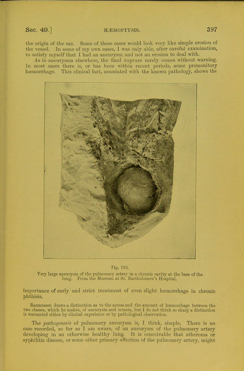 the origin of the sac. Some of these cases would look very like simple erosion of the vessel. In some of my own cases, I was only able, after careful examination, to satisfy myself that I had an aneurysm and not an erosion to deal with. As in aneurysms elsewhere, the final rupture rarely comes without warning. In most cases there is, or has been within recent periods, some premonitory haemorrhage. This clinical fact, associated with the known pathology, shows the Fig. 102. Very large aneurysm of the pulmonary artery in a chronic cavity at the base of the hing. From the Museum at St. Bartholomew's Hospital. importance of early and strict treatment of even slight hasmorrhage in chronic phthisis. Rasmussen draws a distinction as to the access and the amount of haamorrhago between the two classes, which he makes, of aneurysm and ectasia, but I do not think so sharp a distinction is warranted either by clinical experience or by pathological observation. The pathogenesis of pulmonary aneurysm is, I think, simple. There is no case recorded, so far as I am aware, of an aneurysm of tlie pulmonary artery developing in an otherwise healthy lung. It is conceivable that atheroma or syphilitic disease, or some other primary affection of the pulmonary artery, might