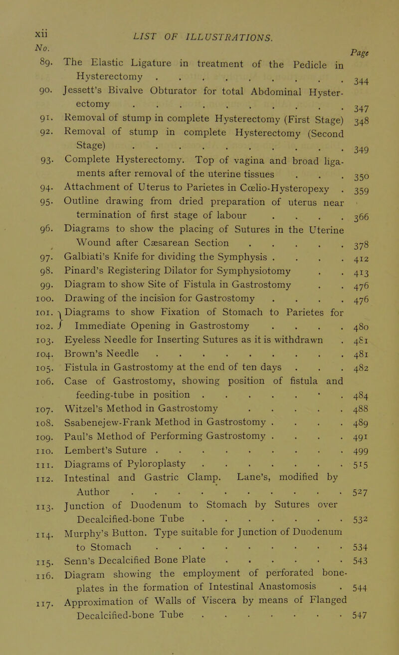 No. LIST OF ILLUSTRATIONS. Page 89. The Elastic Ligature in treatment of the Pedicle in Hysterectomy 90. Jessett’s Bivalve Obturator for total Abdominal Hyster- ectomy 91. Removal of stump in complete Hysterectomy (First Stage) 92. Removal of stump in complete Hysterectomy (Second Stage) 93. Complete Hysterectomy. Top of vagina and broad liga- ments after removal of the uterine tissues 94. Attachment of Uterus to Parietes in Ccelio-Hysteropexy . 95. Outline drawing from dried preparation of uterus near termination of first stage of labour .... 96. Diagrams to show the placing of Sutures in the Uterine Wound after Caesarean Section .... * 97. Galbiati’s Knife for dividing the Symphysis .... 98. Pinard’s Registering Dilator for Symphysiotomy gg. Diagram to show Site of Fistula in Gastrostomy 100. Drawing of the incision for Gastrostomy .... 101. ^ Diagrams to show Fixation of Stomach to Parietes for 102. / Immediate Opening in Gastrostomy .... 103. Eyeless Needle for Inserting Sutures as it is withdrawn X04. Brown’s Needle 105. Fistula in Gastrostomy at the end of ten days 106. Case of Gastrostomy, showing position of fistula and feeding-tube in position • 107. Witzel’s Method in Gastrostomy 108. Ssabenejew-Frank Method in Gastrostomy .... 109. Paul’s Method of Performing Gastrostomy .... no. Lembert’s Suture hi. Diagrams of Pyloroplasty 1x2. Intestinal and Gastric Clamp. Lane’s, modified by Author 113. Junction of Duodenum to Stomach by Sutui'es over Decalcified-bone Tube 114. Murphy’s Button. Type suitable for Junction of Duodenum to Stomach 115. Senn’s Decalcified Bone Plate 116. Diagram showing the employment of perforated bone- plates in the formation of Intestinal Anastomosis 117. Approximation of Walls of Viscera by means of Flanged Decalcified-bone Tube 344 347 348 349 350 359 366 378 412 413 476 476 480 4S1 481 482 484 488 489 491 499 5i5 527 532 534 543 544 547